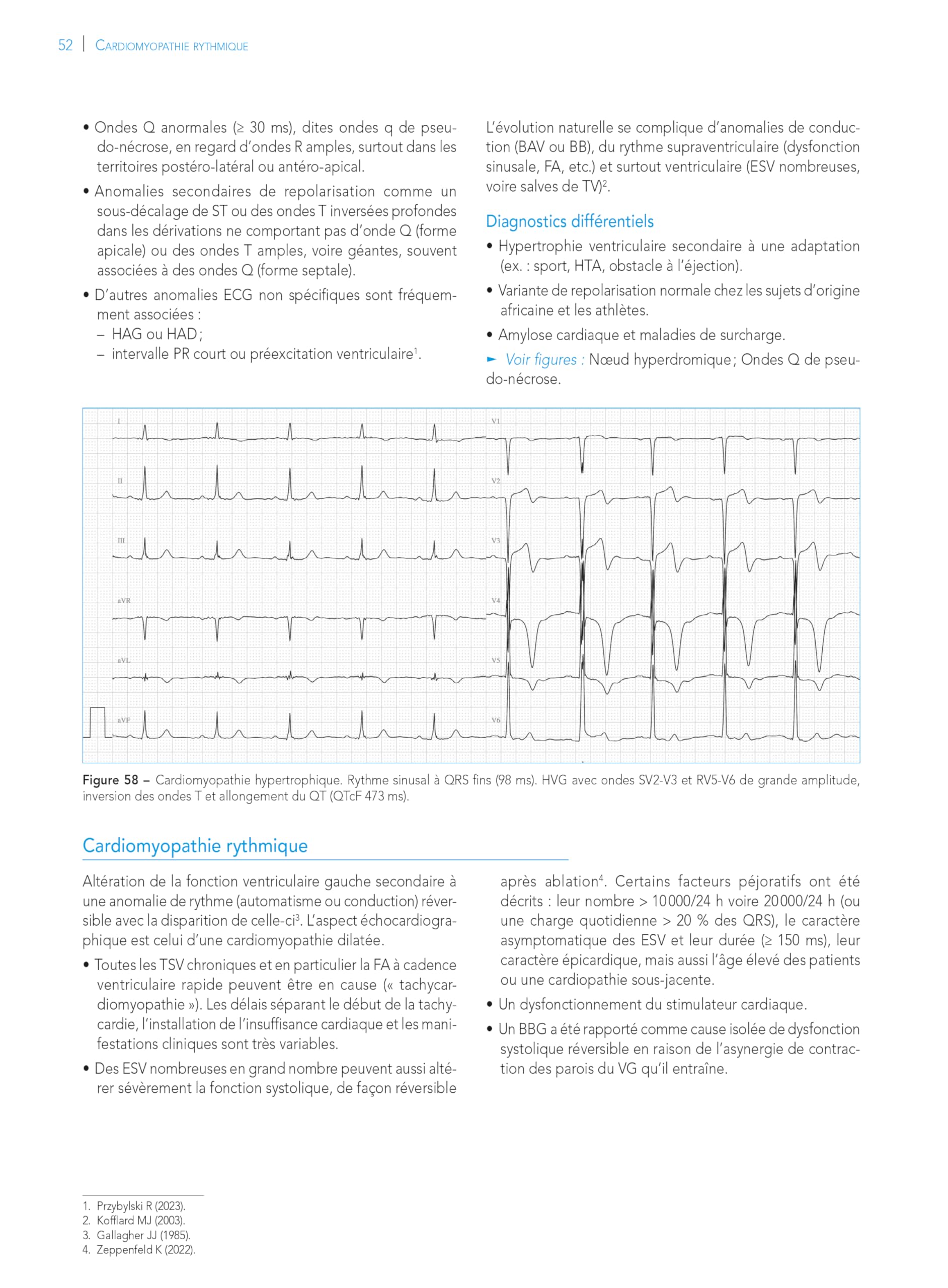 L'ECG de A à Z, 2e éd.
