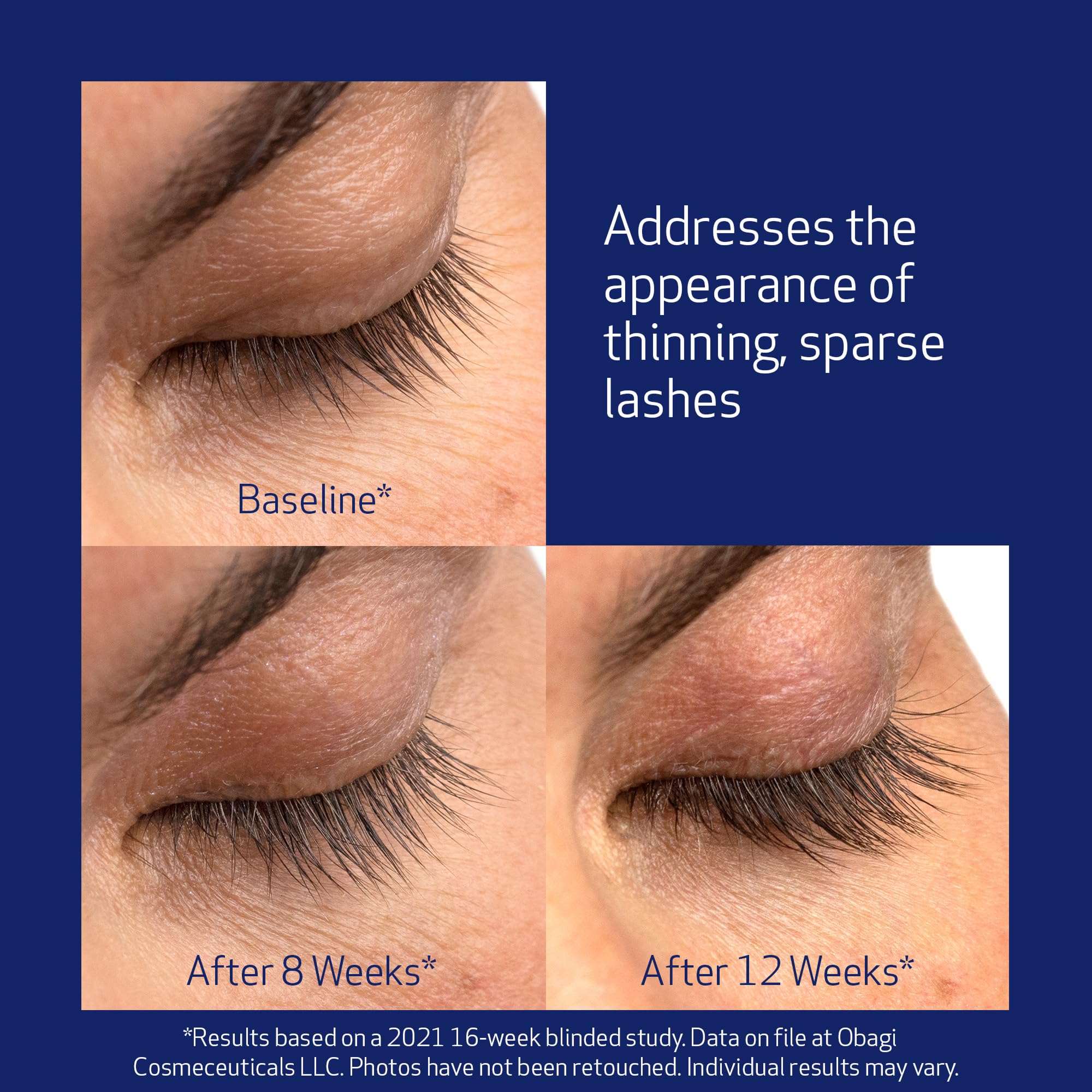 Obagi Nu-Cil Eyelash Enhancing Serum 3ml - Conditioning Lash Serum for Longer Fuller Healthier-Looking Eyelashes, Nourishes Sparse & Brittle Lashes, Once-Daily Cosmetic Lash Enhancer, Precise Applicator