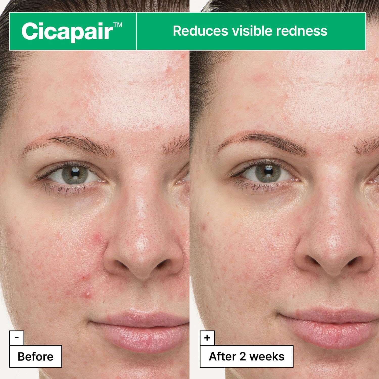 Dr.Jart+ Cicapair - Trattamento Viso 30 ml (Confezione da 2)