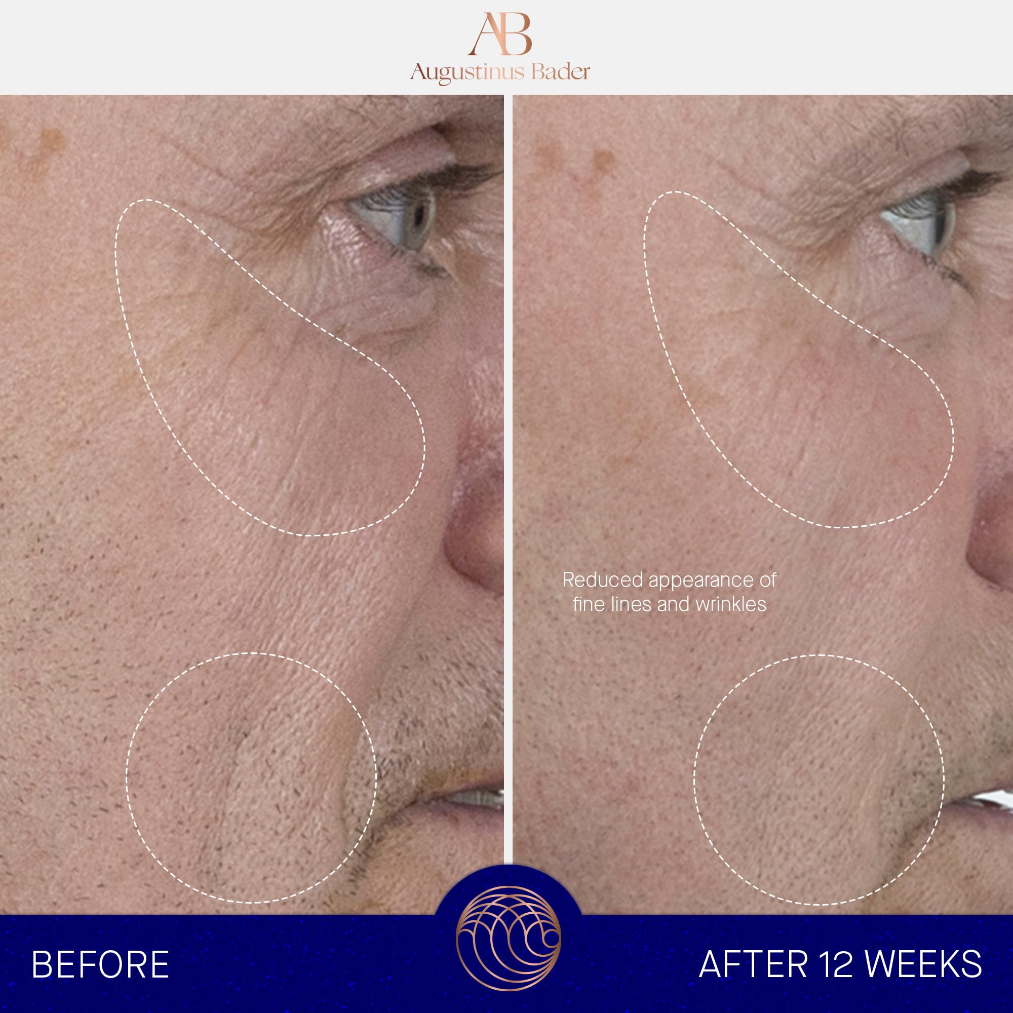 Augustinus Bader The Serum – Luxury Hydrating Anti-Aging Face Serum – Boosts Firmness, Smooths Fine Lines & Evens Skin Tone