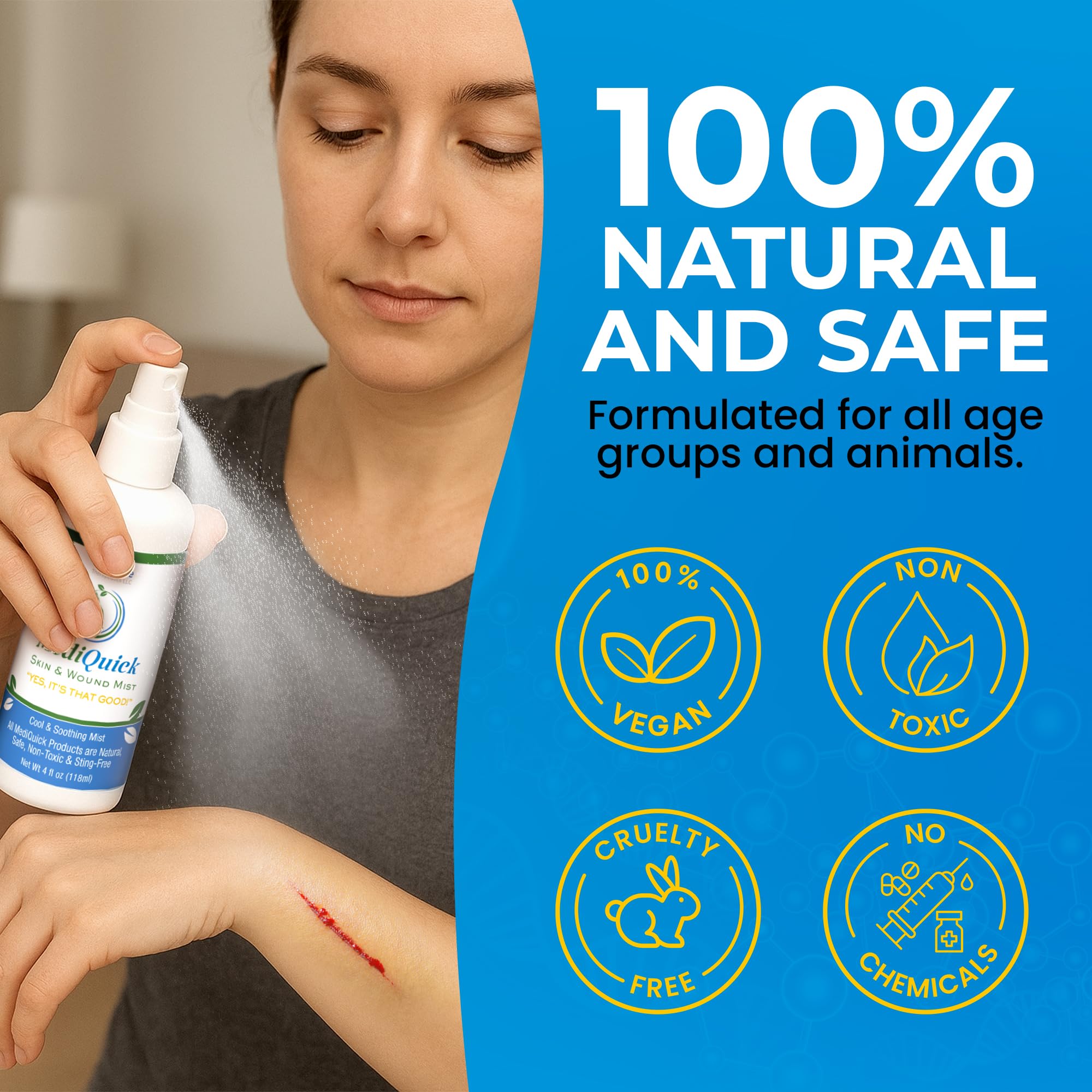 MediQuick Mgiełka w sprayu z kwasem podchlorowym, spray antyseptyczny bez żądła, 113 g | Naturalny żel do pielęgnacji ran na oparzenia słoneczne, skaleczenia, trądzik, ochrona 12 godzin