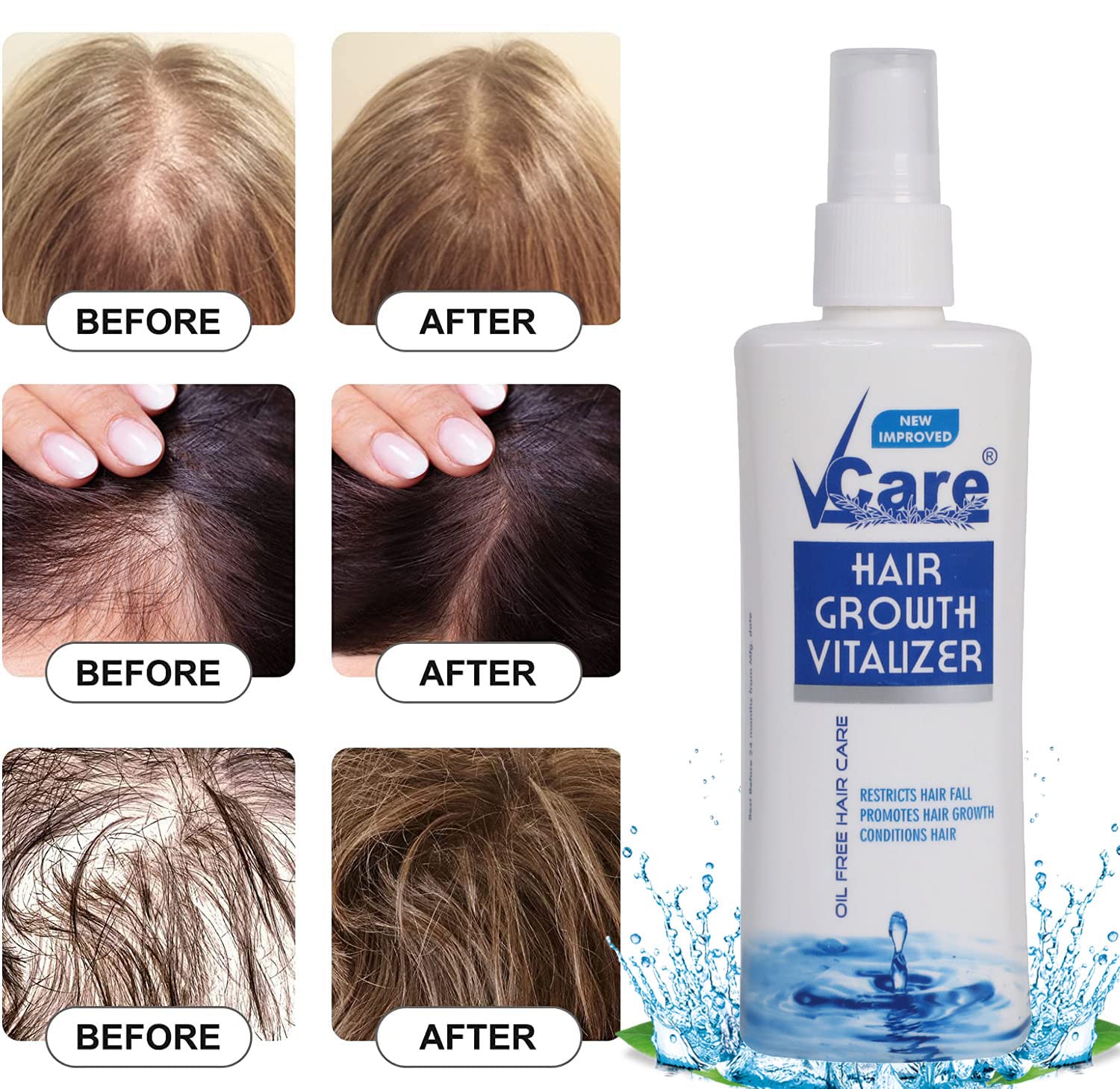 Aggregate 61+ vcare hair growth serum in.eteachers