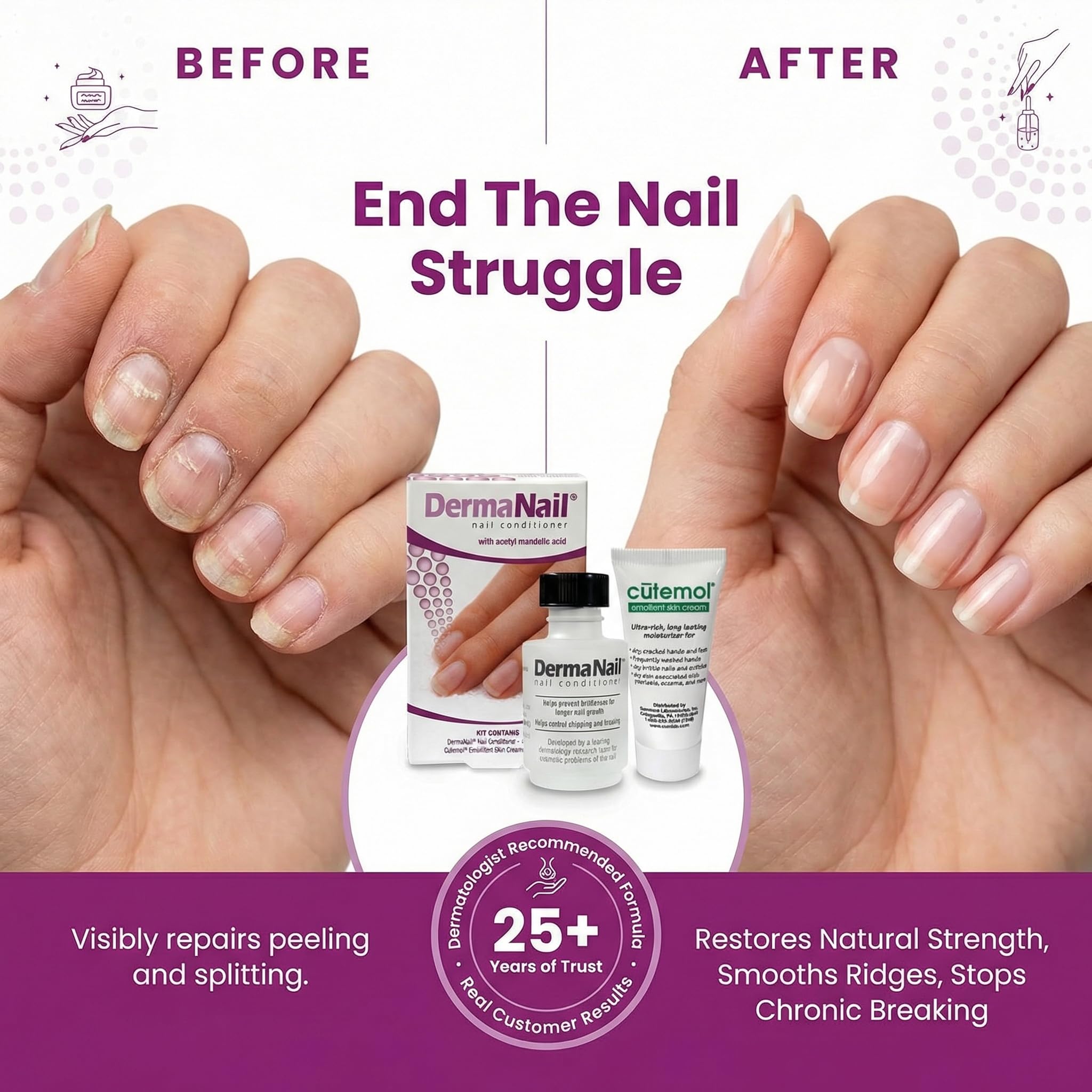 DermaNail Acondicionador de uñas, 1 oz