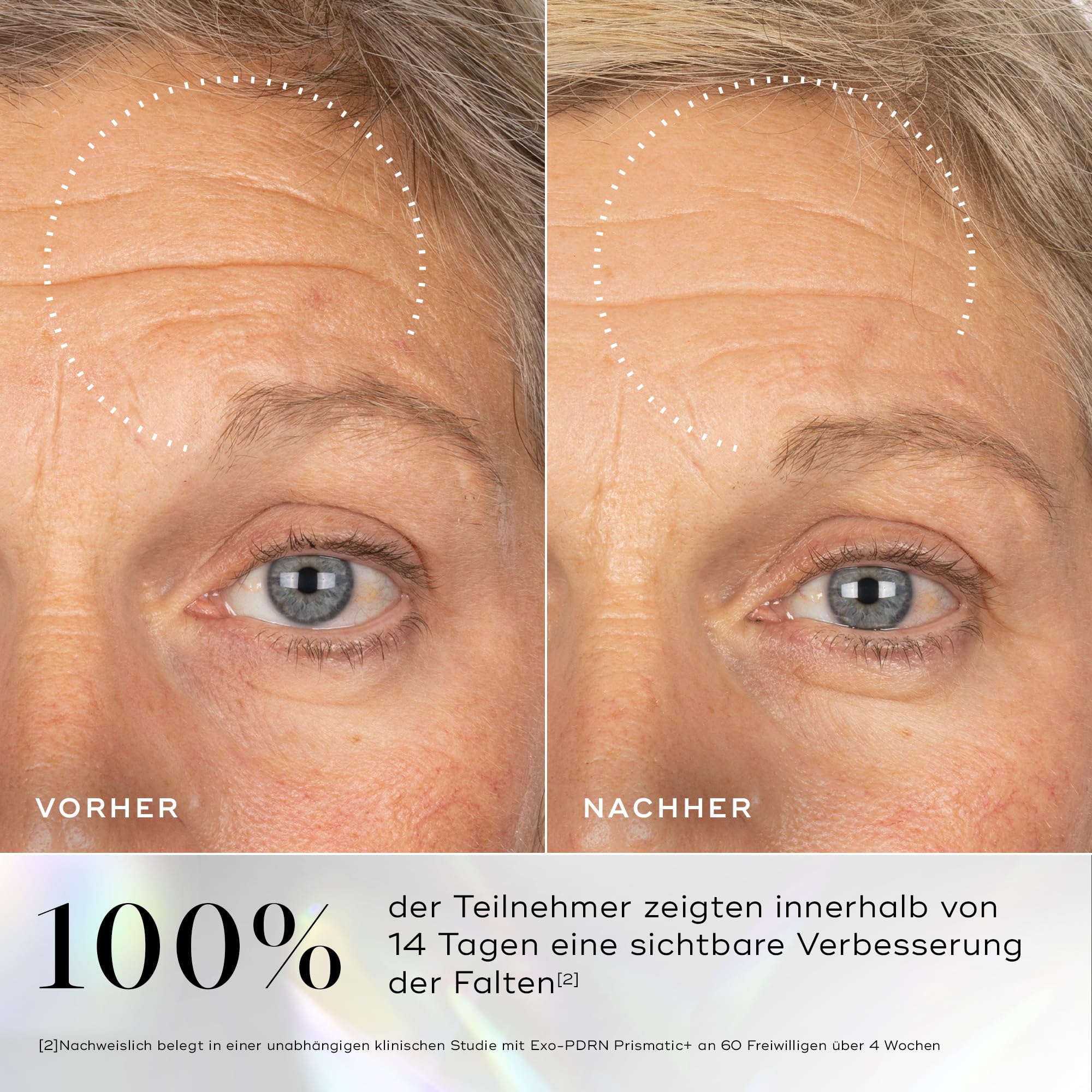 Medik8 Exo-PDRN Prismatic+, Serum für Vitalität, Triple-Exosom - 30 ml | Inspiriert von Polynukleotid-Behandlungen; 60% tieferes Eindringen als Lachs-DNA; prismatisches PDRN, 3-fach Exosom-Komplex