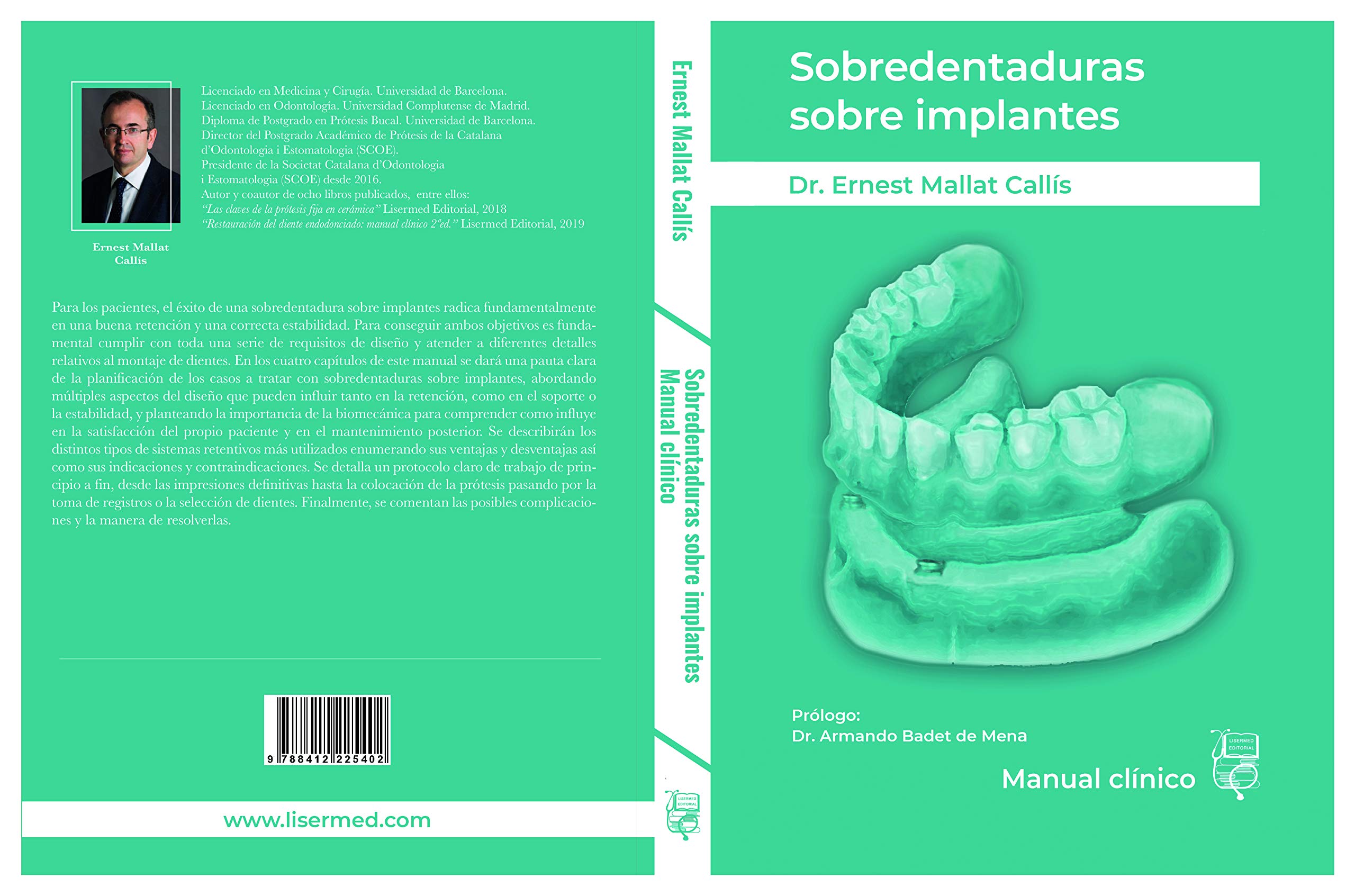 Sobredentaduras sobre implantes: Manual Clínico