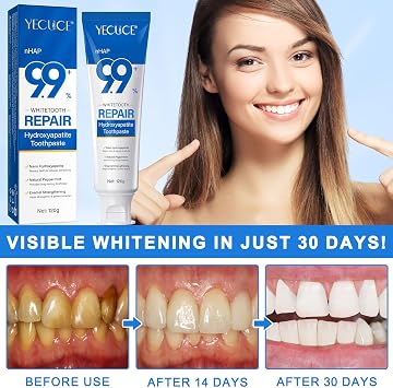 9.9% Hydroxyapatite Toothpaste for Enamel Repair and Tooth Strengthening, Nano Hydroxyapatite Remineralizing Toothpaste, Fluoride Free Gentle Whitening Tooth Paste for Sensitive Teeth, Fresh Mint