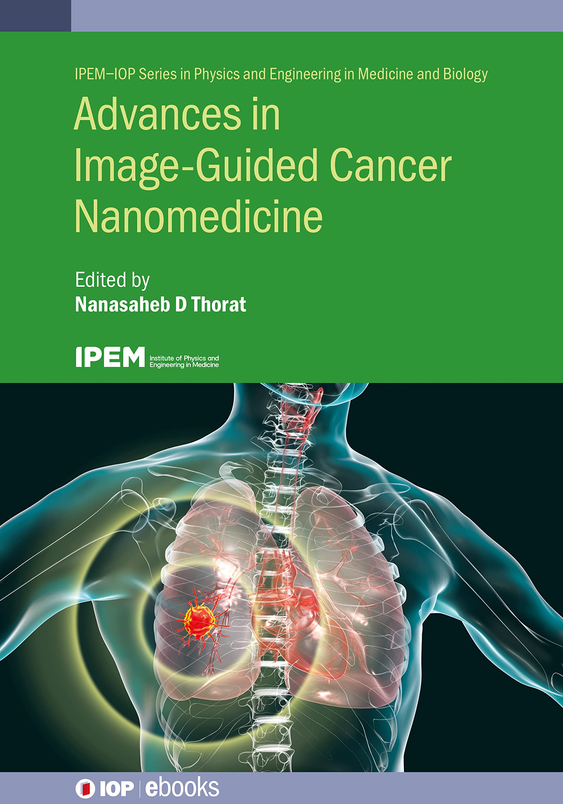 Buy Advances in Image Guided Cancer Nanomedicine (IPEM-IOP Series in Physics and Engineering in Medicine and Biology) — BookShops.in