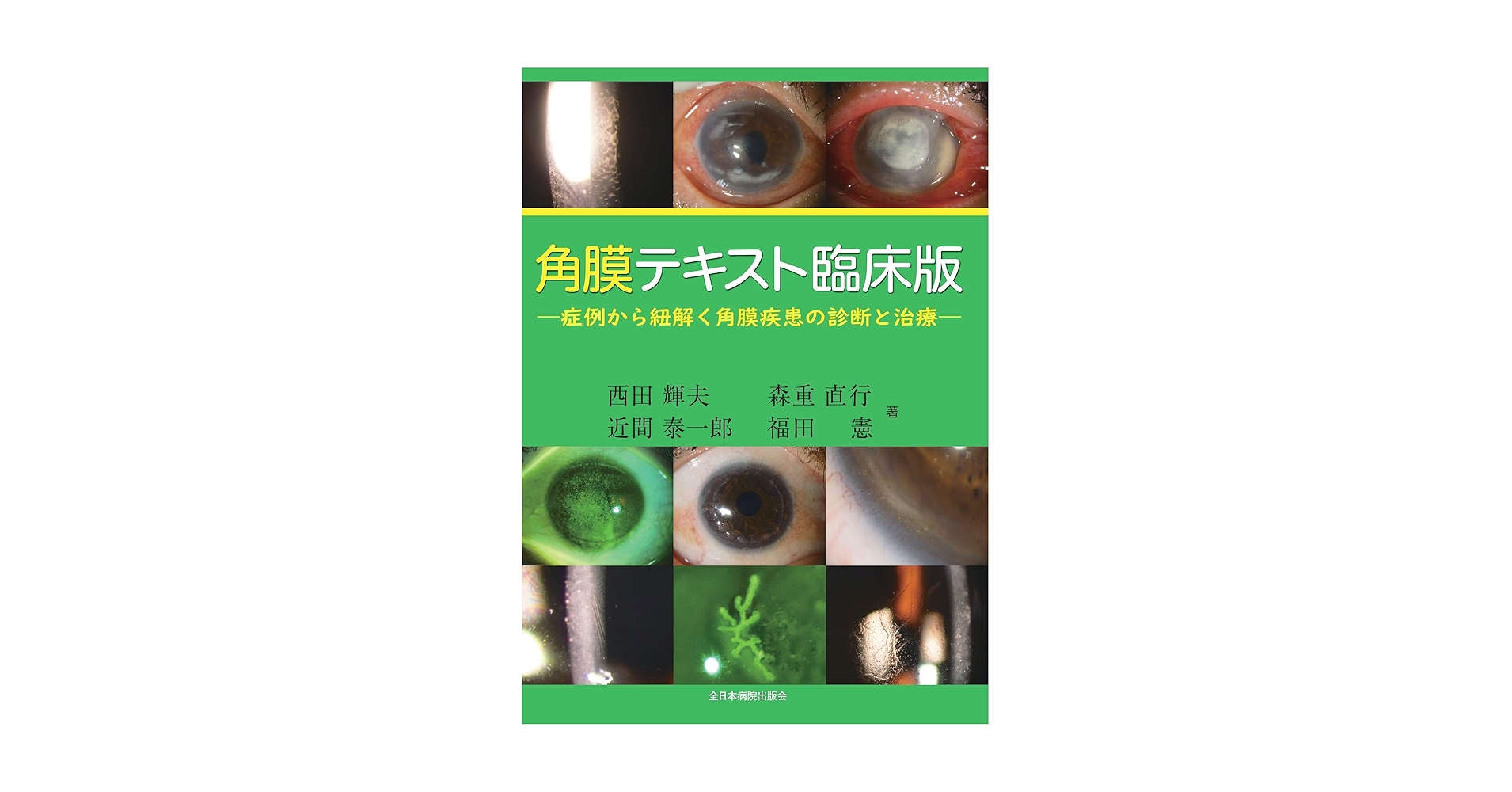 角膜テキスト臨床版ー症例から紐解く角膜疾患の診断と治療ー