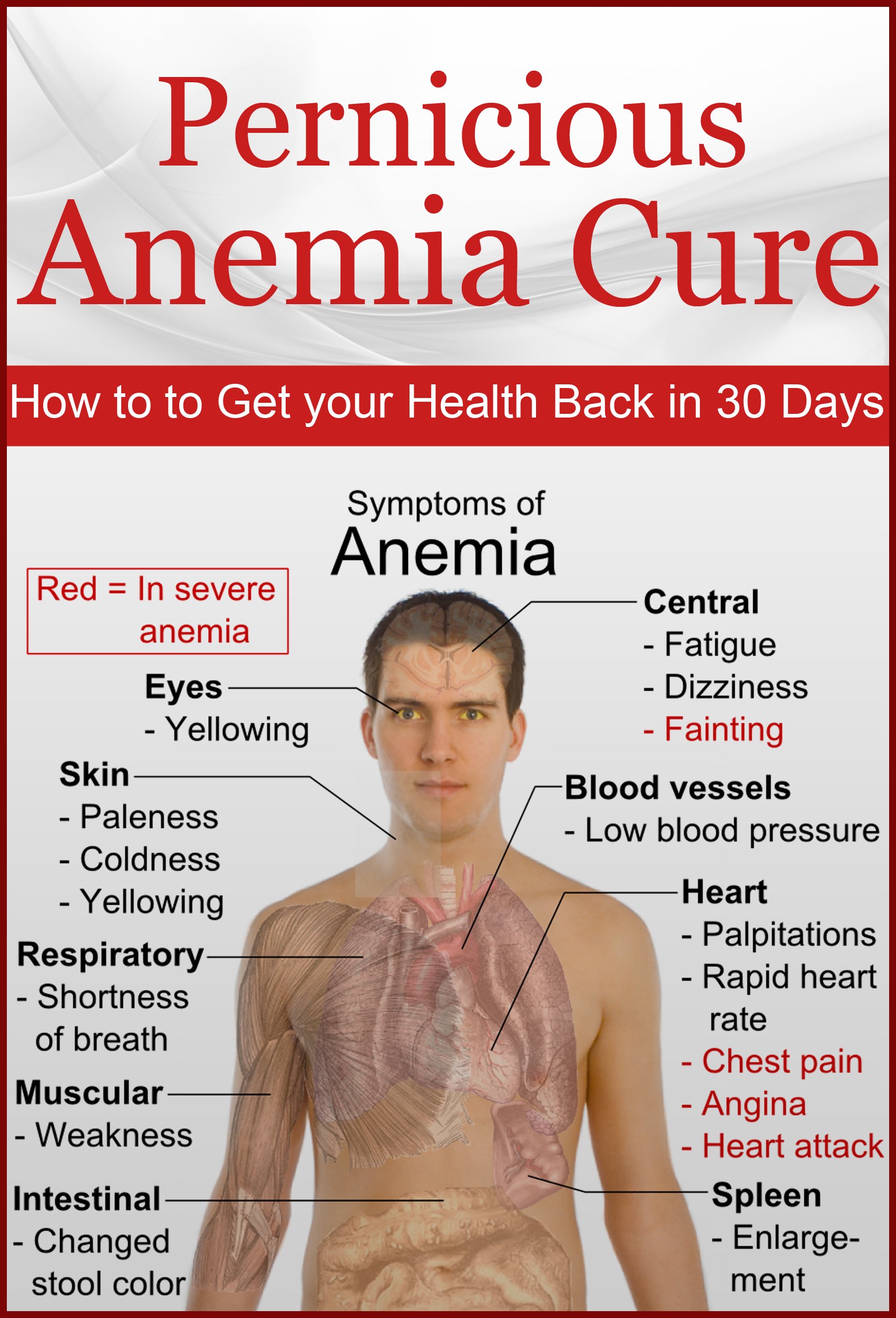 Buy Pernicious Anemia Cure How to Get Your Back in 30 Days (anemia