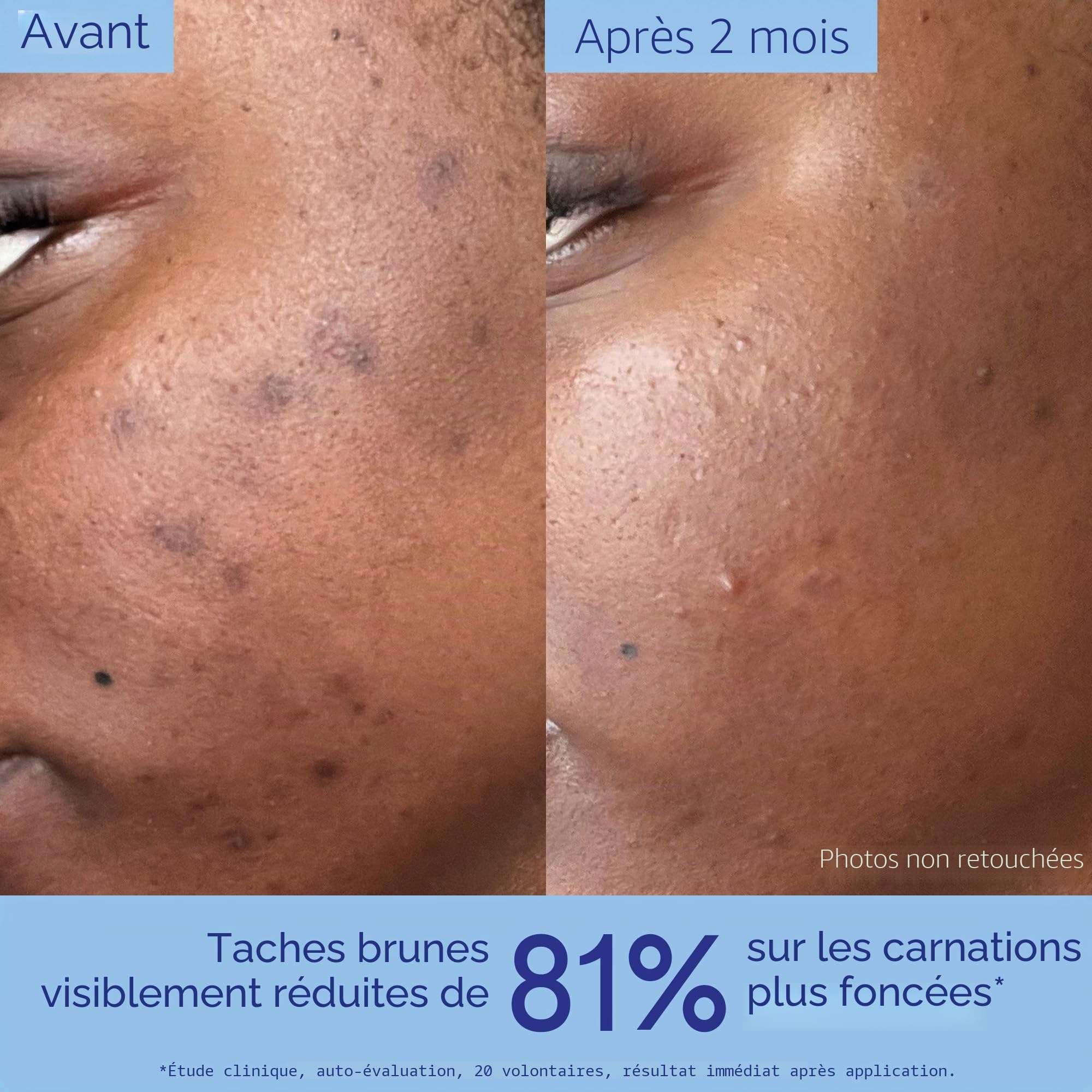 Caudalie Vinoperfect Sérum éclaircissant pour taches brunes 50 ml