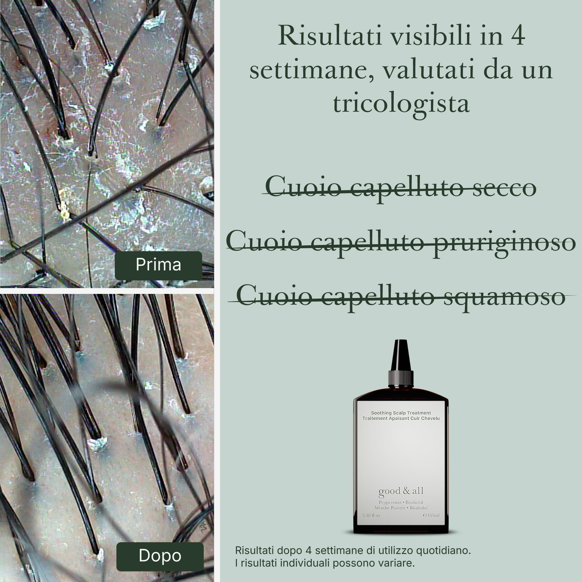Good&All Trattamento Anti Prurito per il Cuoio Capelluto Secco e Sensible - Senza Risciacquo, senza Profumo, Vegano - 165ml