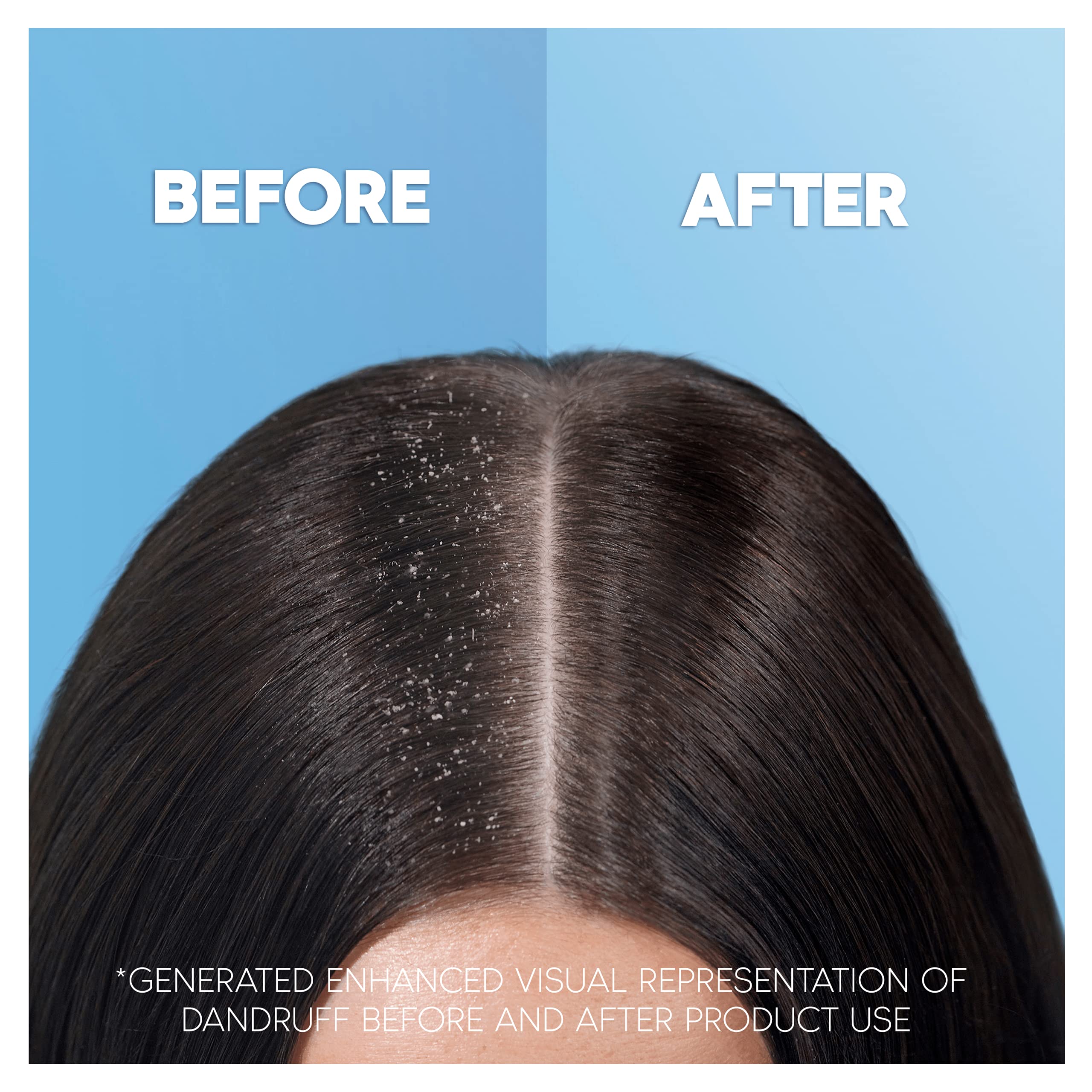 Buy Head & Shoulders Classic Clean Anti Dandruff Shampoo in Refillable Aluminium Shampoo Bottle