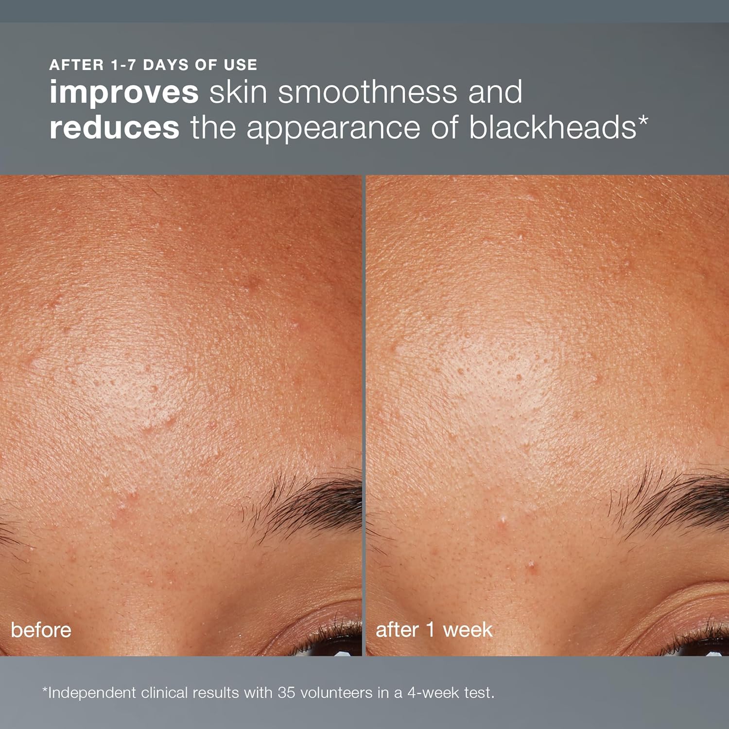 Dermalogica Daily Microfoliant, Face Exfoliator Scrub Powder with Salicylic Acid and Papaya Enzyme, Achieve Brighter, Smoother Skin Daily - Image 4