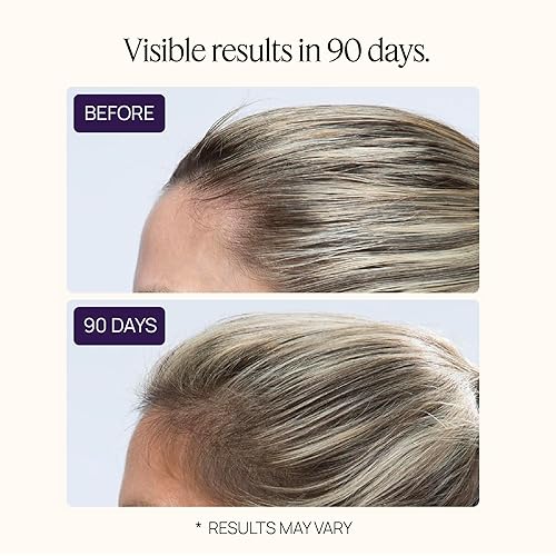 Miniatura 6 de Hair Growth Peptides Gummies, Doctor Recommended, Patented Follicle Fortifying Biotechnology, Clinically Shown to Reduce Hair Loss