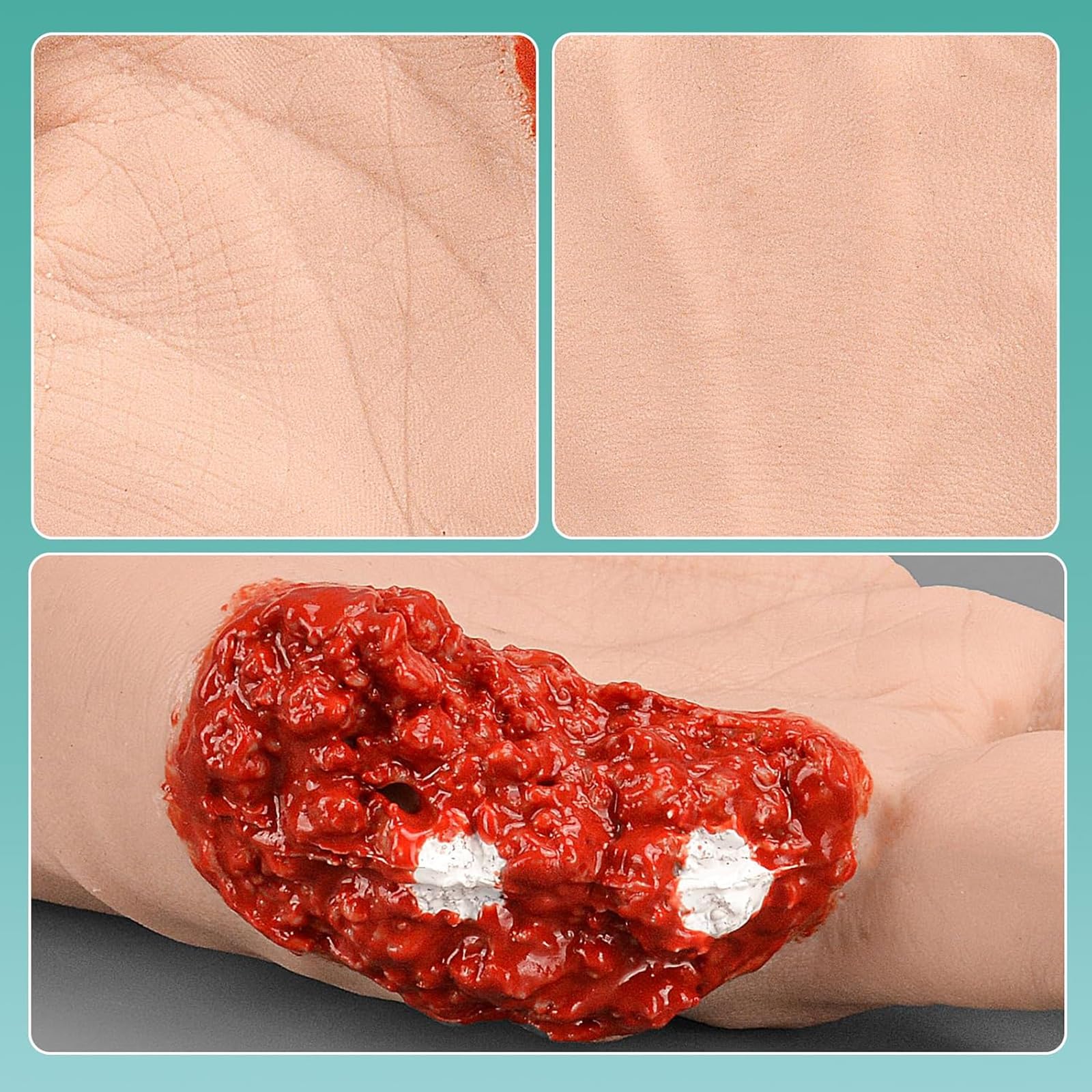 Kit De Formation À La Pose De Pansements Pour La Main, Modèle D'entraînement À La Pose De Pansements Pour La Main, Modèle De Pratique De L'hémostase Des Plaies D'amputation De La Paume, Simulation