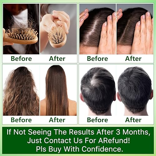 Miniatura 6 de Aceite de romero para el crecimiento del cabello con suero para el crecimiento del cabello, spray para el crecimiento del cabello 6 en 1 con