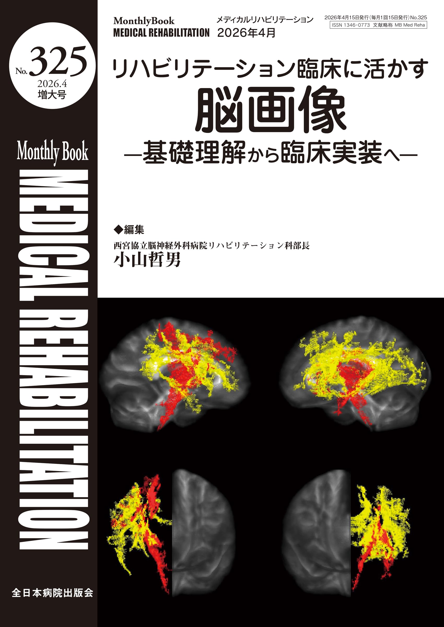 リハビリテーションにおける脳画像の活用（阿部浩明先生） 阿部浩明先生】脳画像 × 臨床：脳画像マスターシリーズ2026 ②水平断