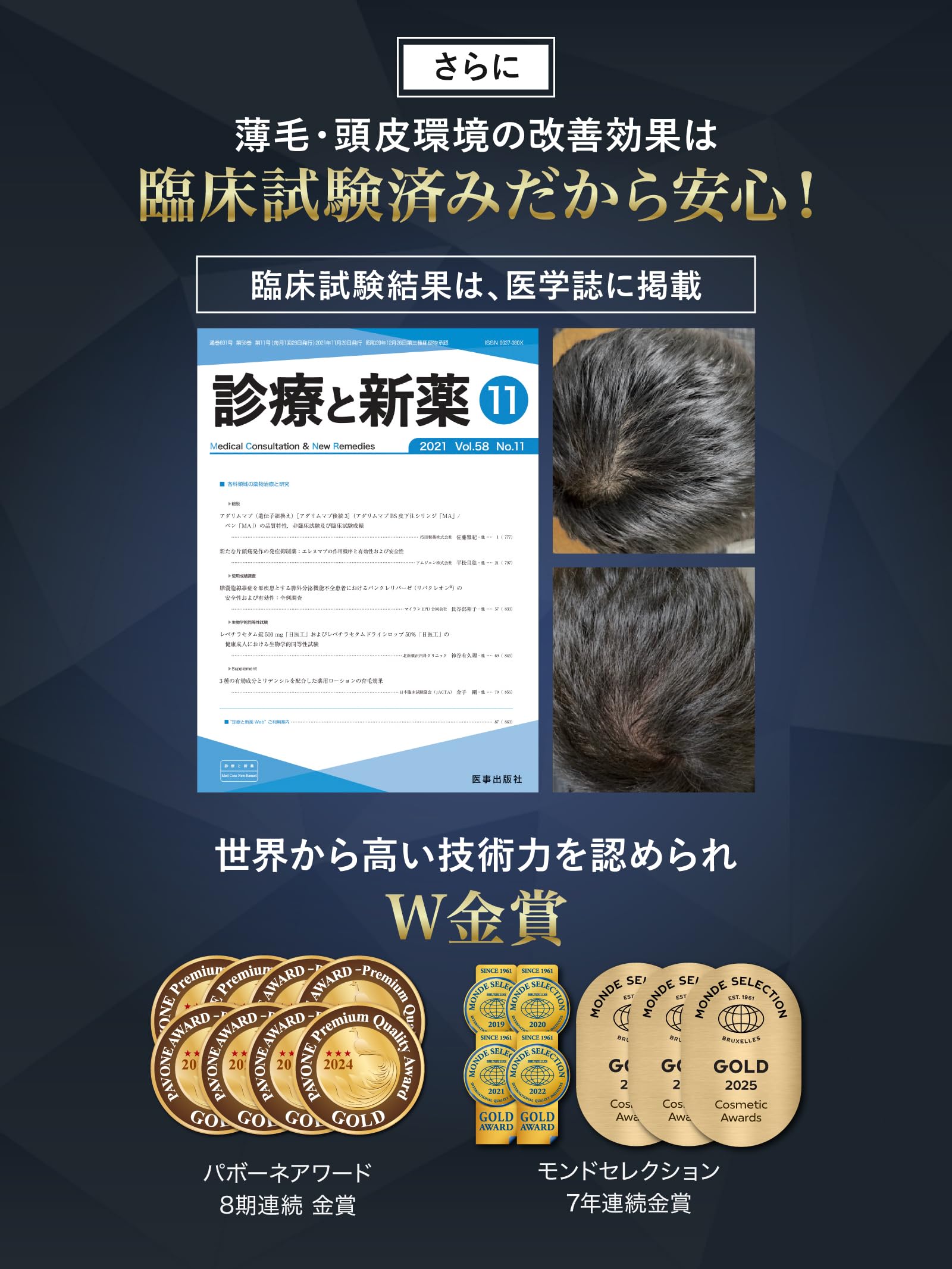Amazon | 医薬部外品 REDEN リデン育毛剤 男女兼用 (3本セット