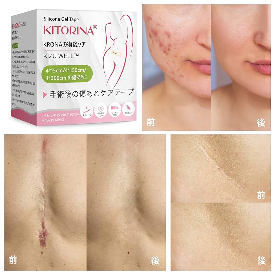 クリニセルS 傷あとケア（火傷 ケガ 手術あと 帝王切開あと） クリニセル【龍野マルゼン薬店】