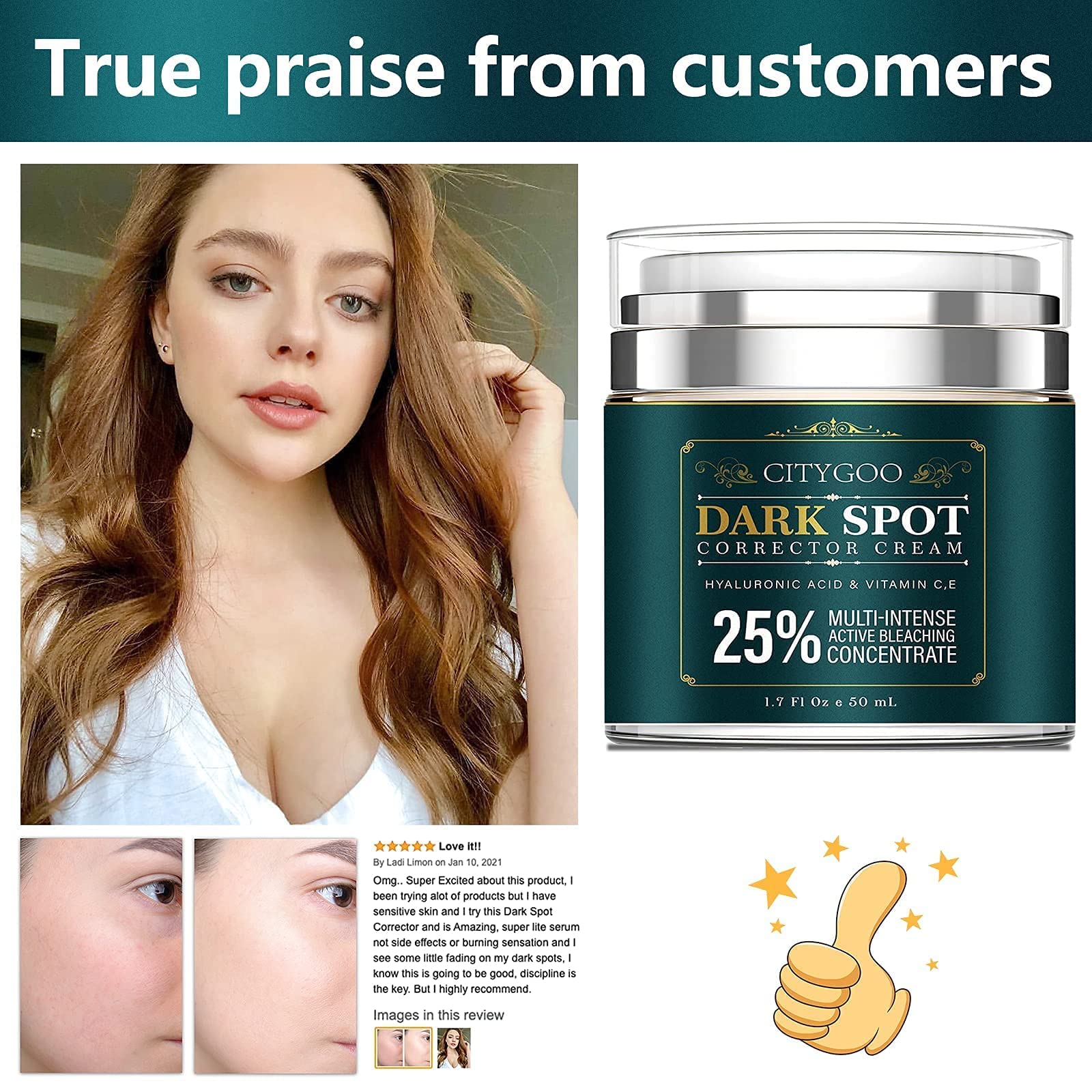 CITYGOO Dark Spot Remover for Face and Body, Dark Spot Corrector Cream