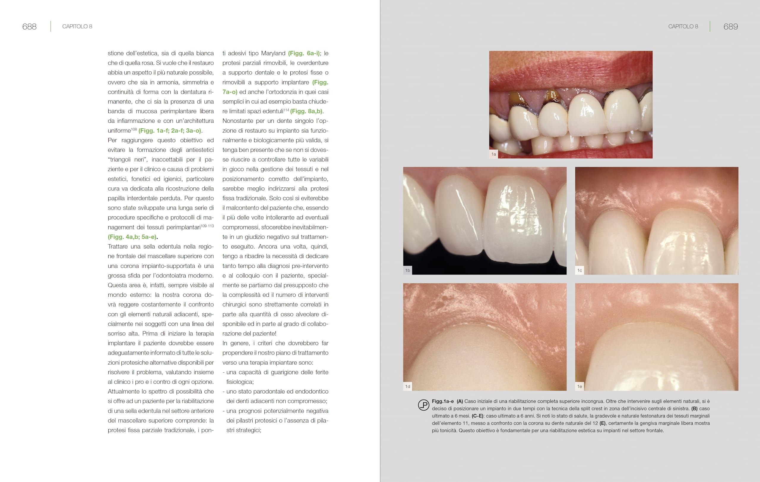 Bioestetica nella riabilitazione orale