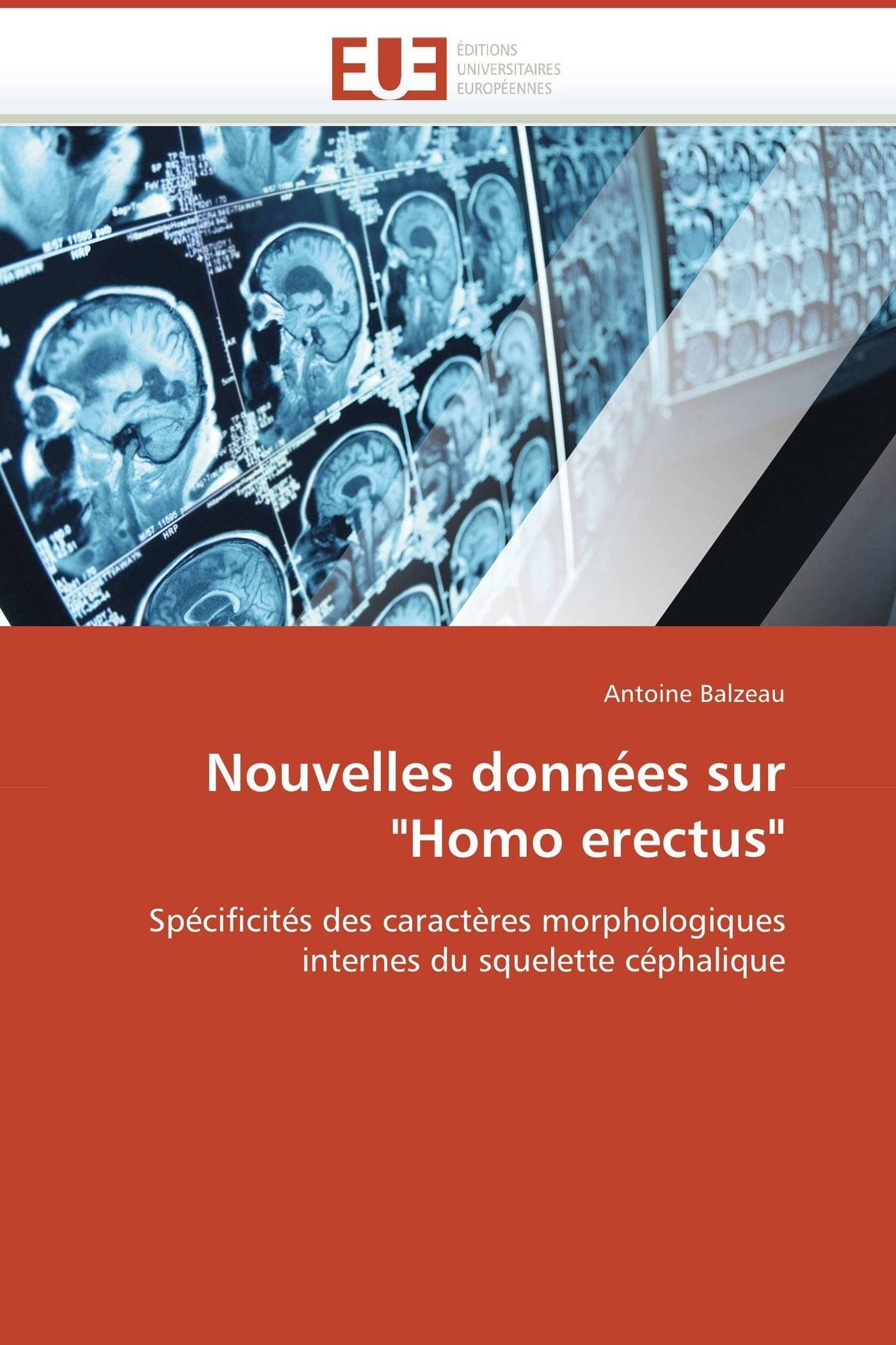 Nouvelles données sur "Homo erectus": Spécificités des caractères morphologiques internes du squelette céphalique (Omn.Univ.Europ.)