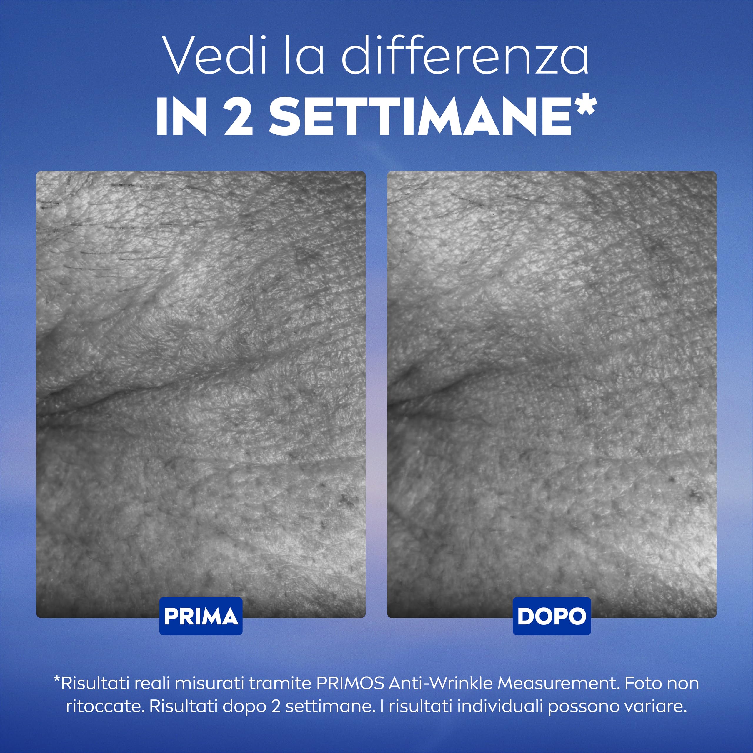 NIVEA Cellular Epigenetics Siero Ringiovanente 30 ml, Siero viso antirughe che riduce i segni dell'età in 2 settimane, Face serum con Acido Ialuronico ed Epicelline, Skincare per tutti i tipi di pelle