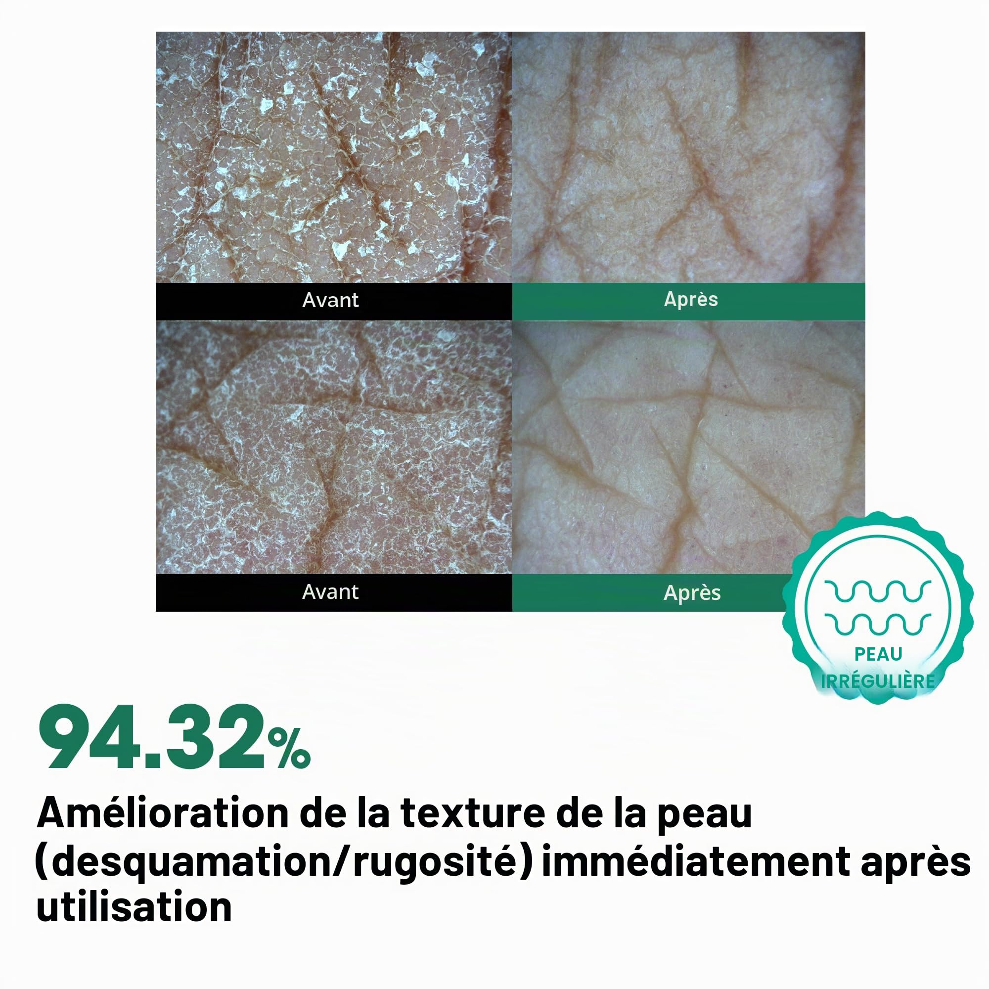 SOME BY MI AHA BHA PHA 30 Days Miracle Toner Mist – 140 ml – Spray pour l'acné corporel pour le dos et la poitrine, exfoliant avec acide salicylique, arbre à thé, niacinamide – Soin coréen de la peau