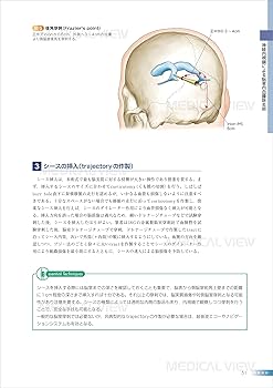 脳室を征服する (新NS NOW 13) メジカルビュー社｜脳神経外科｜新NS NOW 13 脳室を征服する