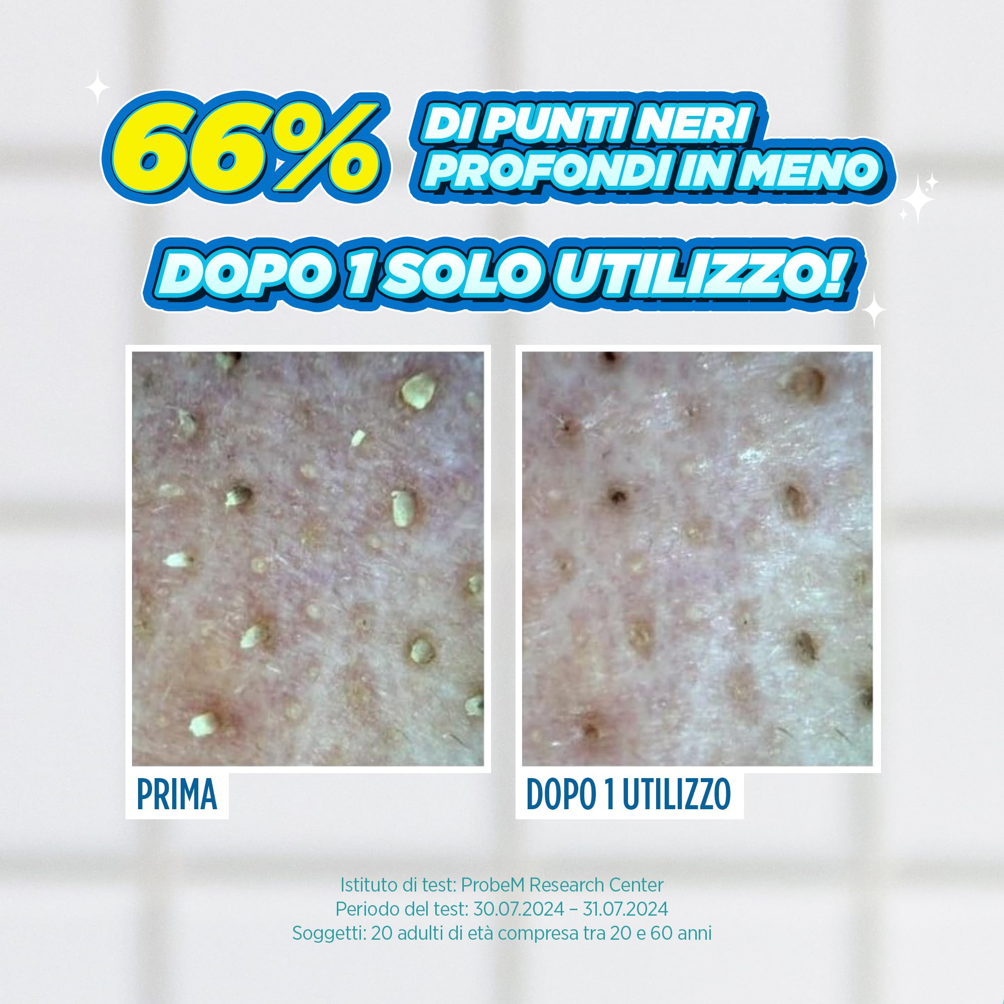 JUMISO Set Di Dischi Di Cotone Ammorbidenti Per Rimuovere Punti Neri - Cura Coreana Dei Pori, Esfoliazione Con Pha, Acqua Di Hamamelide, Tea Tree E Cipresso, Controllo Sebo. Kit Completo 150