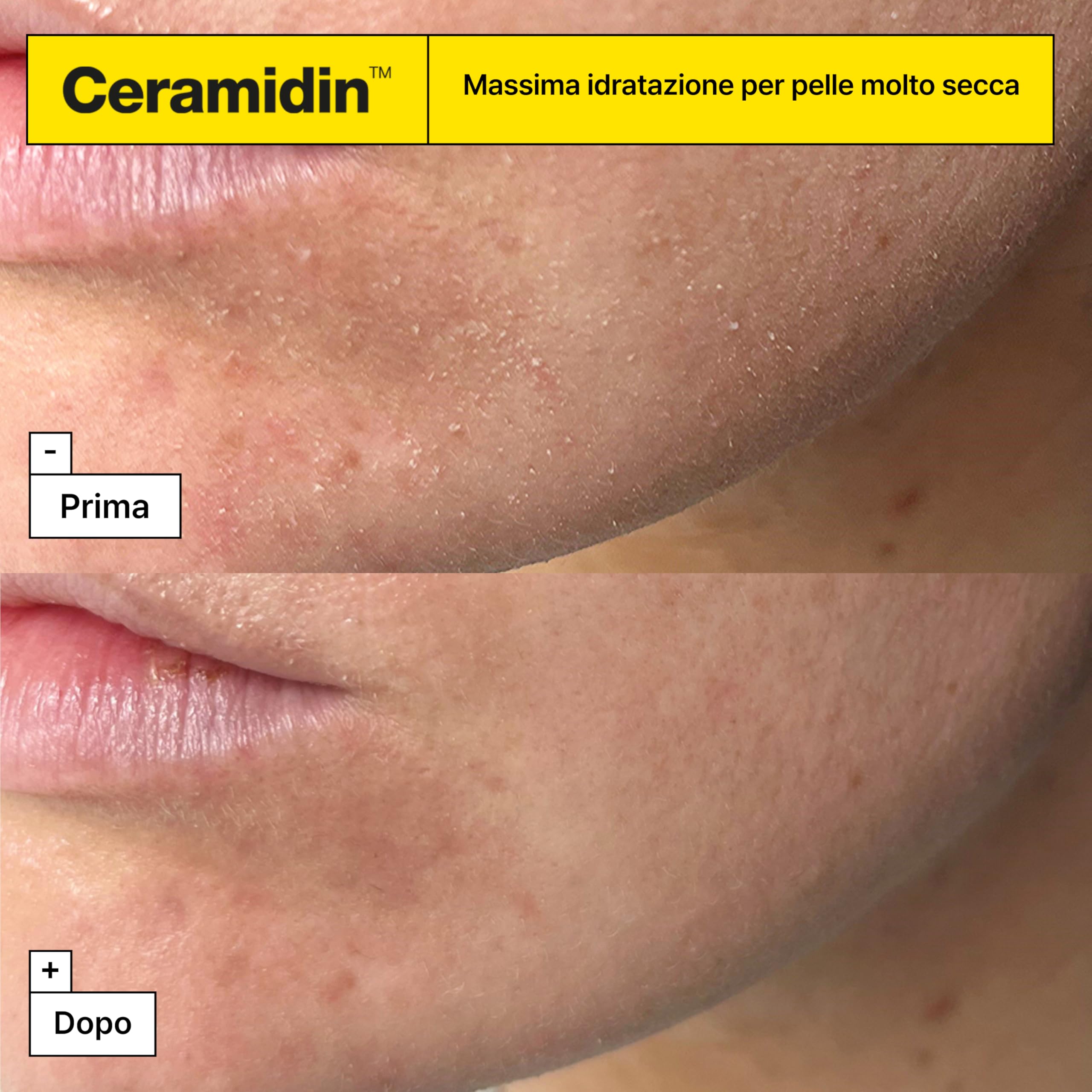 Dr.Jart+ Ceramidin Ectoin-Infused - Crema Viso Idratante 50 ml | Con Ectoina Per Pelli Disidratate - Skincare Coreana