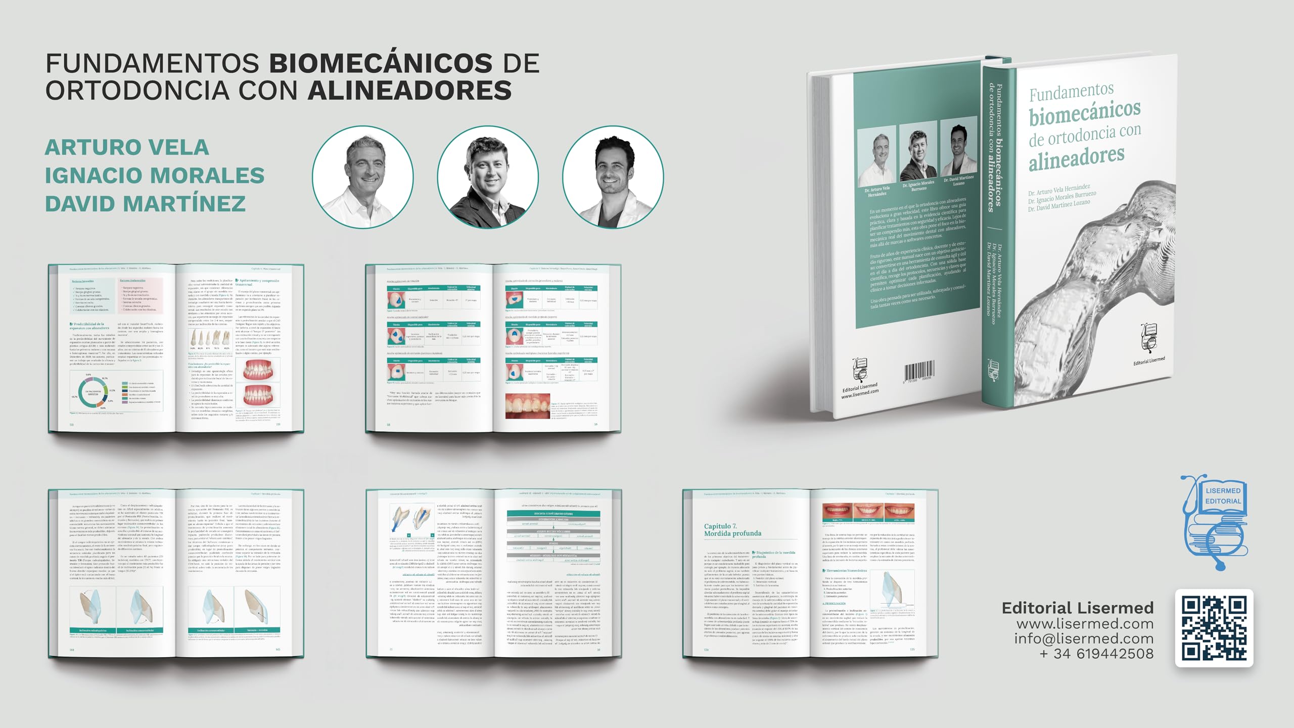 Fundamentos biomecánicos de ortodoncia con alineadores