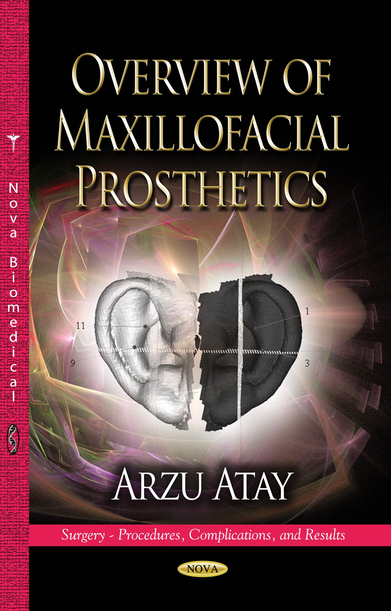 Buy Overview of Maxillofacial Prosthetics (Surgery - Procedures, Complications, and Results) — BookShops.in
