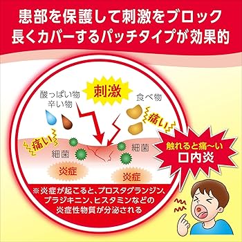 Amazon | 【指定第2類医薬品】口内炎パッチ大正クイックケア 10枚