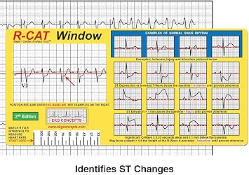 R-CAT EKG Window 2nd Edition | Clear Baseline Window for ST Changes, Color-Coded 12-Lead Interpretation, Calibrated Boxes for Cardiac Intervals