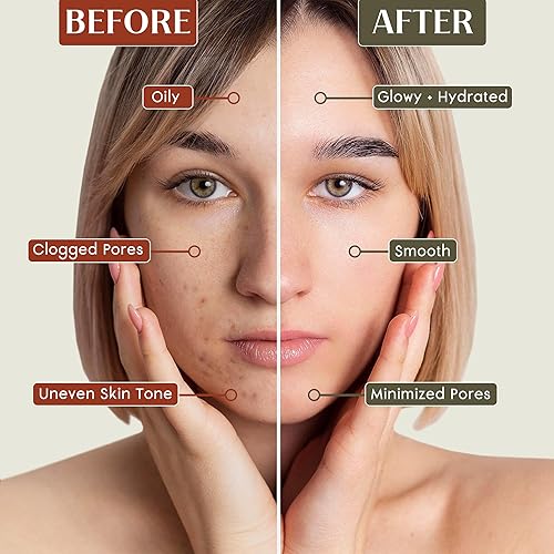 Miniatura 9 de Mascarilla facial de cúrcuma y sándalo de prana  Cuidado natural de la piel  Aclarador e hidratante  Antienvejecimiento  Mascarilla facial de