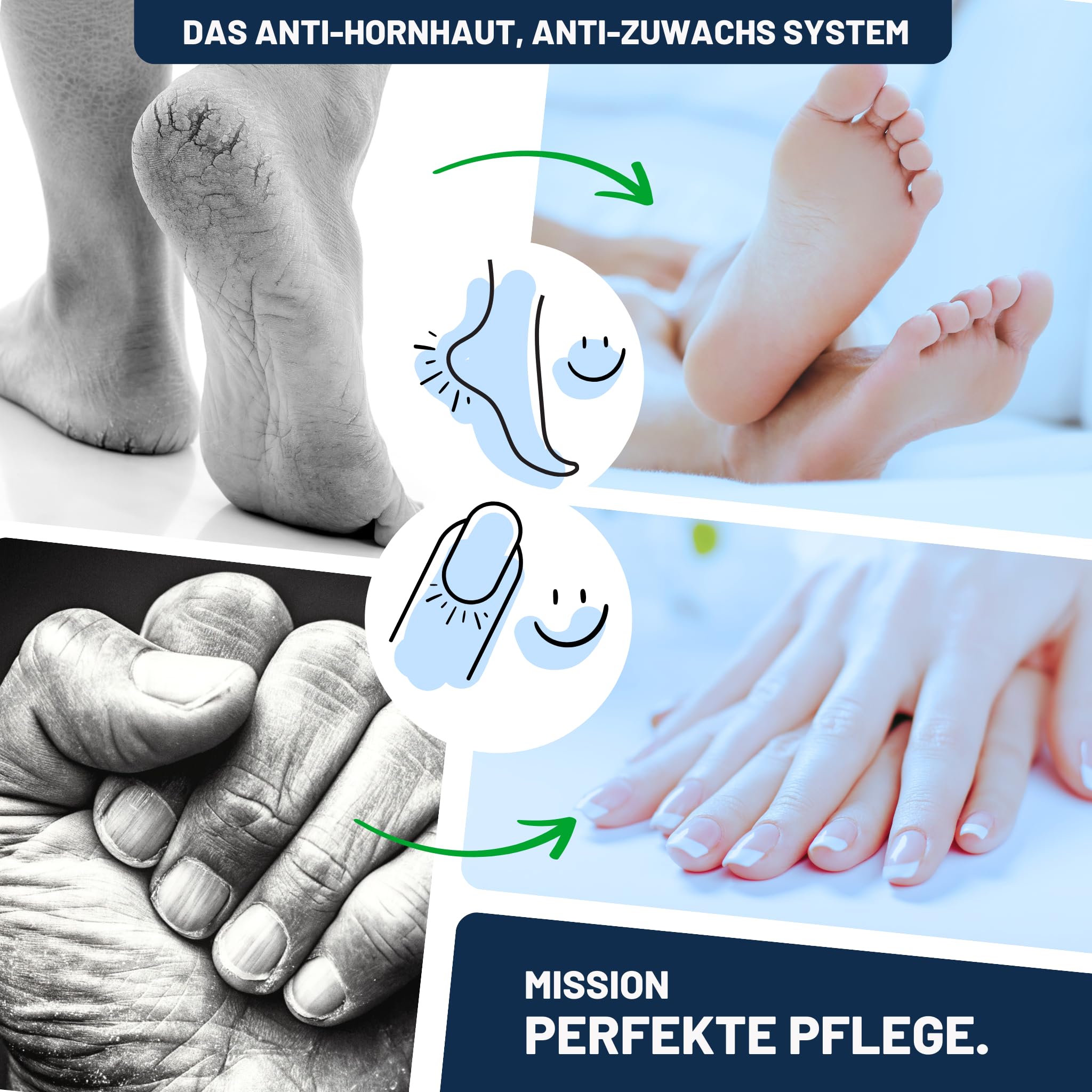 Mr. Fuss Hornhautentferner Aktiv Lösung No. 4 Plus Pack Multi - 3 tlg. Hornhaut Fußpflege Set