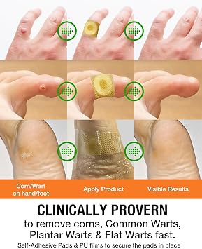 Samsali Wart Corn Remover Pads for Feet: 42 Pack Salicylic Acid Extra Strength Bandages for Plantar Warts Corns Small Callus on Feet Hands Toes - Safe Effective Treatment for Adults Teens