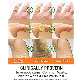 Wart Corn Remover Pads for Feet: 42 Pack 40% Salicylic Acid Extra Strength Bandages for Plantar Warts Corns Small Callus on Feet Hands Toes - Safe Effective Treatment for Adults Children (42 Pads)