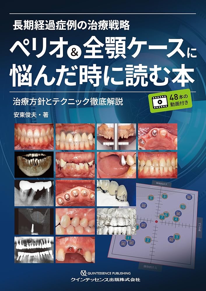 長期経過症例の治療戦略ペリオ&全顎ケースに悩んだ時に読む本 長期経過症例の治療戦略ペリオ&全顎ケースに悩んだ時に読む本