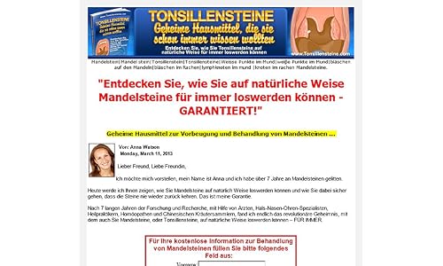 Tonsillensteine – vue 2