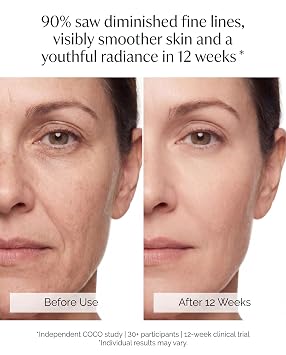 Red Light Therapy for Face, 324 LEDs Red Light Therapy Mask, 4 Color Modes 860nm NIR, Red & Blue Lights for Anti-Wrinkles & Anti-Ance for All Skin Type Treatment, FDA Cleared