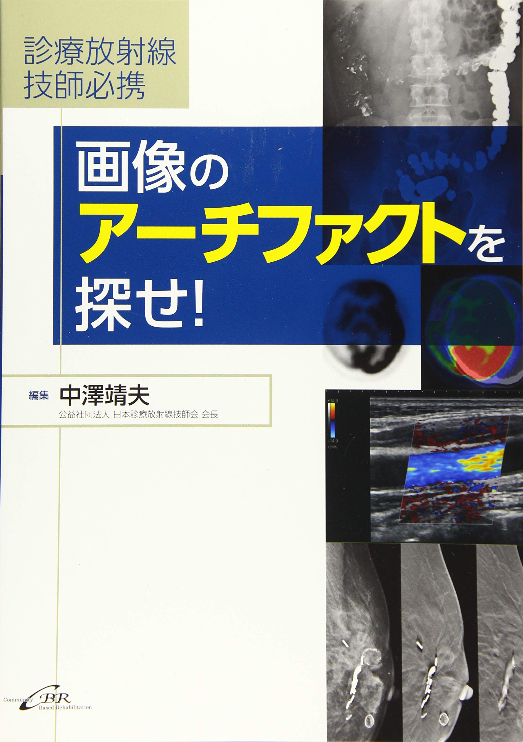 診療放射線技師必携 画像のアーチファクトを探せ！ | 佐野 幹夫, 熊代