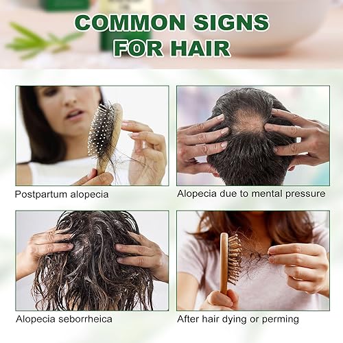 Miniatura 8 de Aceites esenciales de romero, aceite de romero para el crecimiento del cabello, estimula el crecimiento del cabello, nutre el cuero cabelludo y el