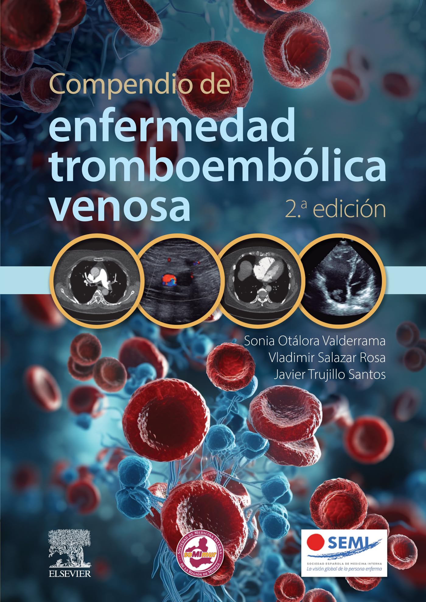 Compendio de enfermedad tromboembólica venosa (Spanish Edition)
