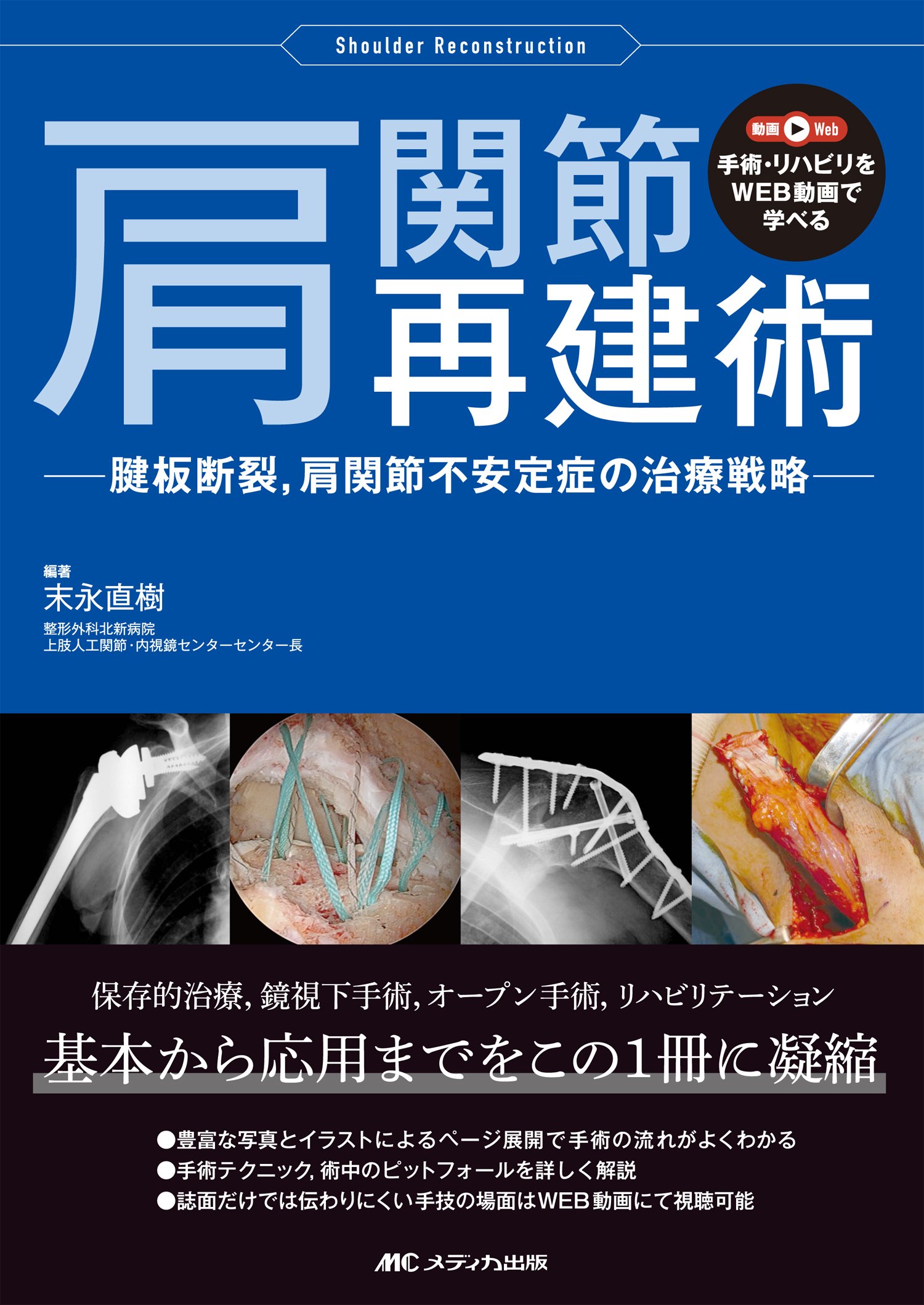 肩関節の術後の理学療法～ 腱板断裂／肩関節不安定症 ～【全３巻・分売不可】 Amazon.co.jp: 肩関節の術後の理学療法～腱板断裂／肩関節不安定