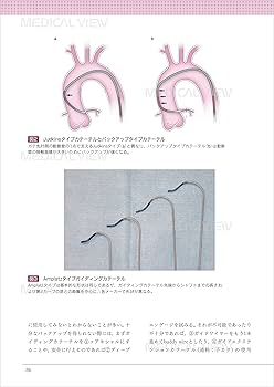 PCIエキスパートになるための28カ条 PCIエキスパートになるための28カ条 : Amazon.com.au