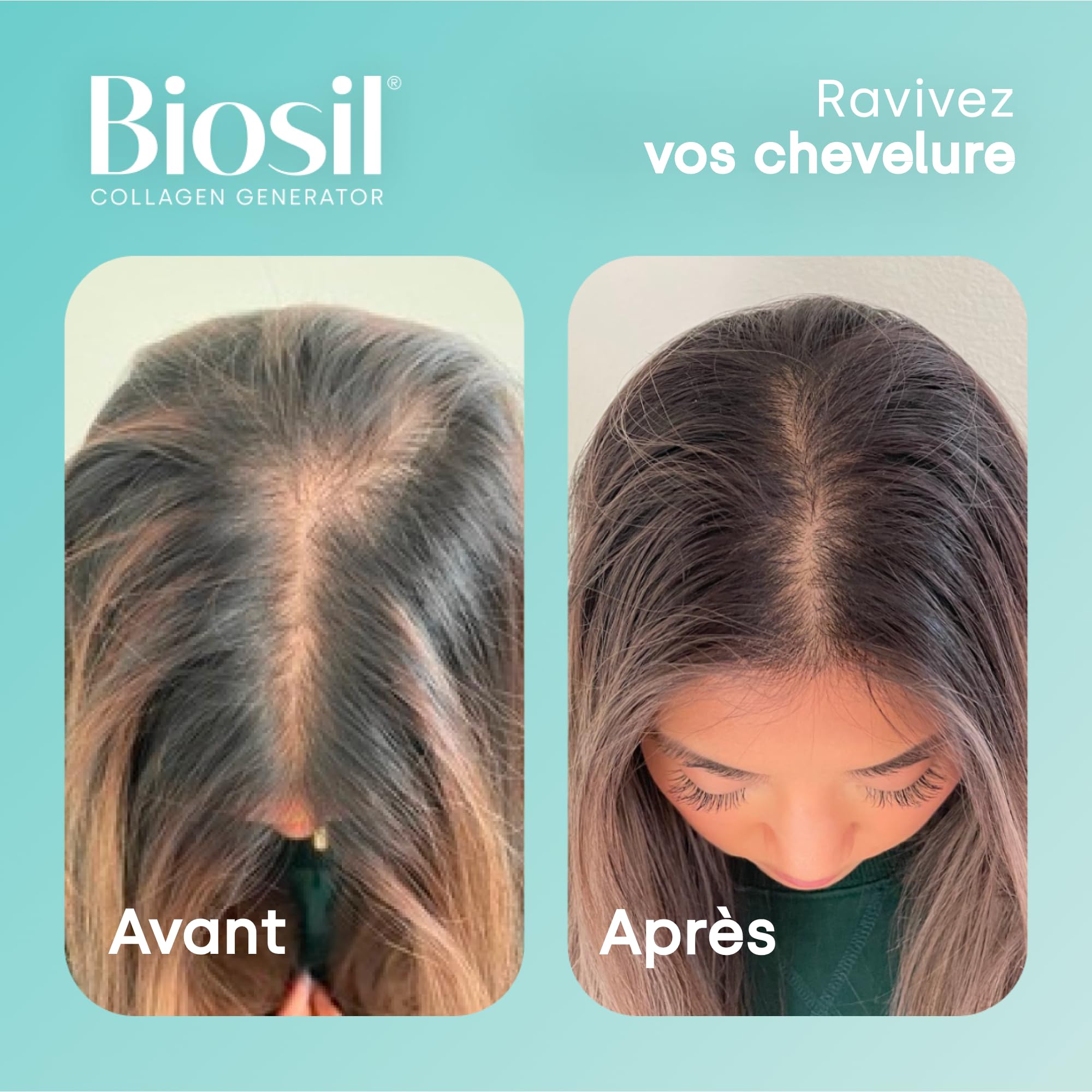 Biosil Collagen Generator - 120 capsules liquides | Avec le complexe breveté ch-OSA - génère et protège votre propre collagène - Sans OGM - Approvisionnement pour 60 jours