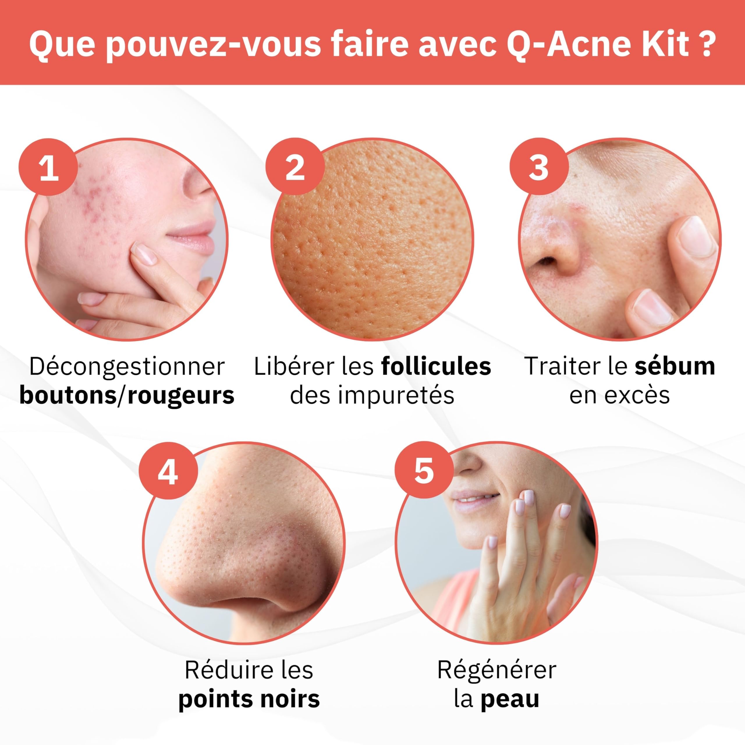 Q1 Q-Acne Complex, Crème Anti Acné à l'Acide Salicylique, Crème Anti Boutons pour le Visage | Elimine les Boutons et les Rougeurs | Traitement Efficace pour l'Acné Juvénile et Hormonale, 40ml