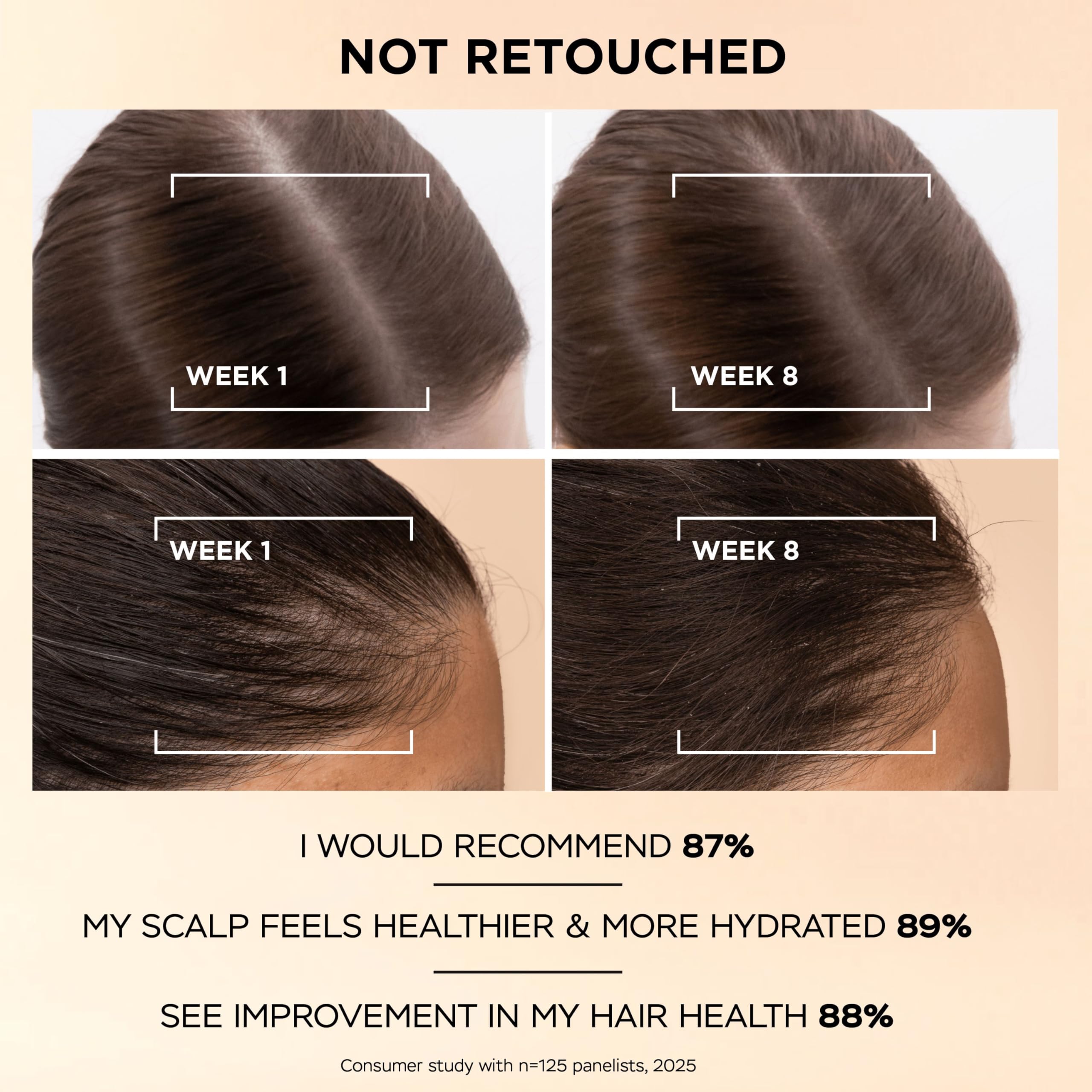 Pantene Grow Abundant Serum gegen Haarausfall, 60 ml, für dickeres, längeres und dichteres Haar in 8 Wochen. Behandlung gegen Haarausfall, für Damen, mit 3000 mg Pro-Vitamin-Komplex